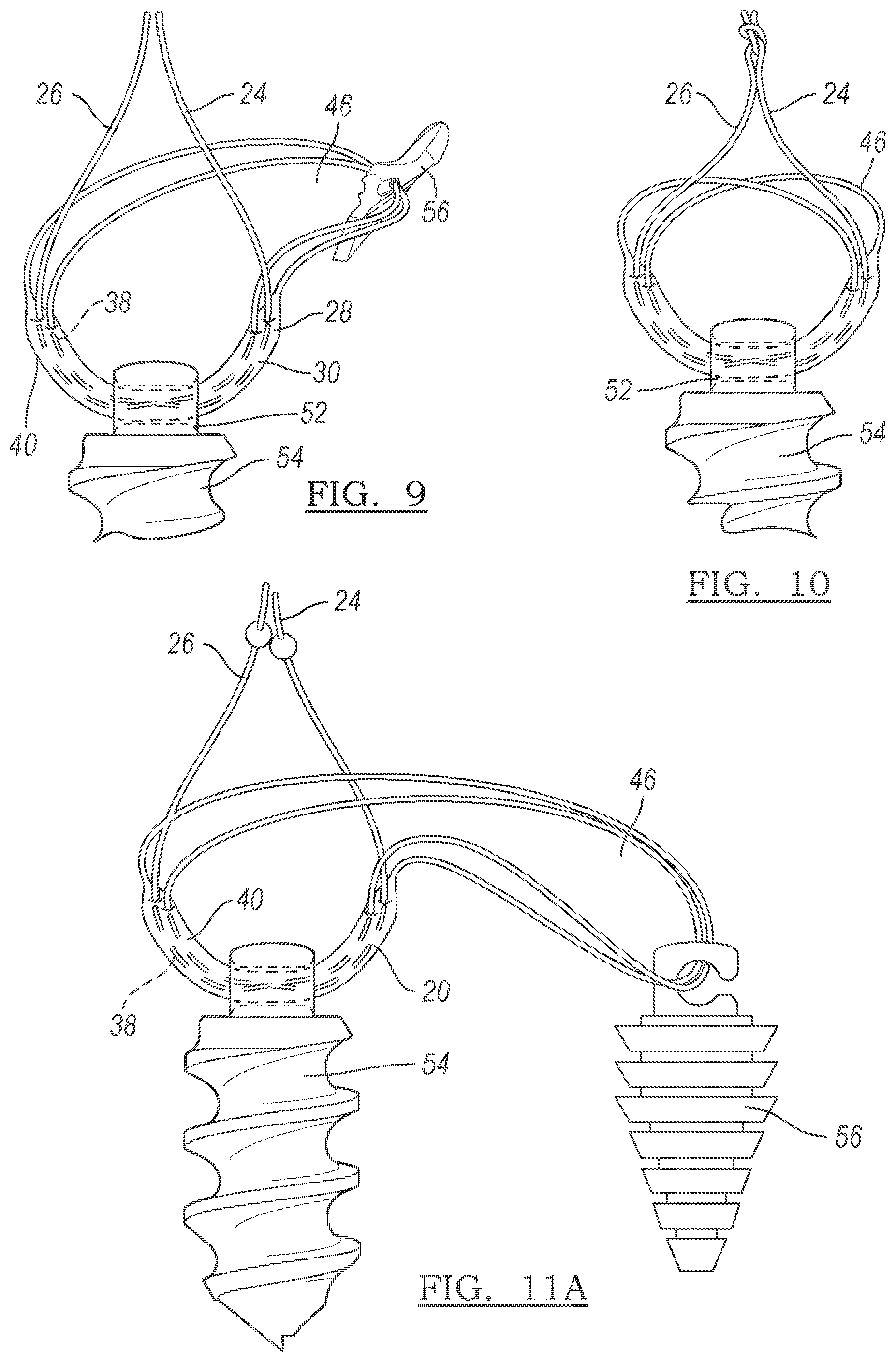 Patent US12096928 Figure 4 – Method and apparatus for coupling soft tissue to a bone