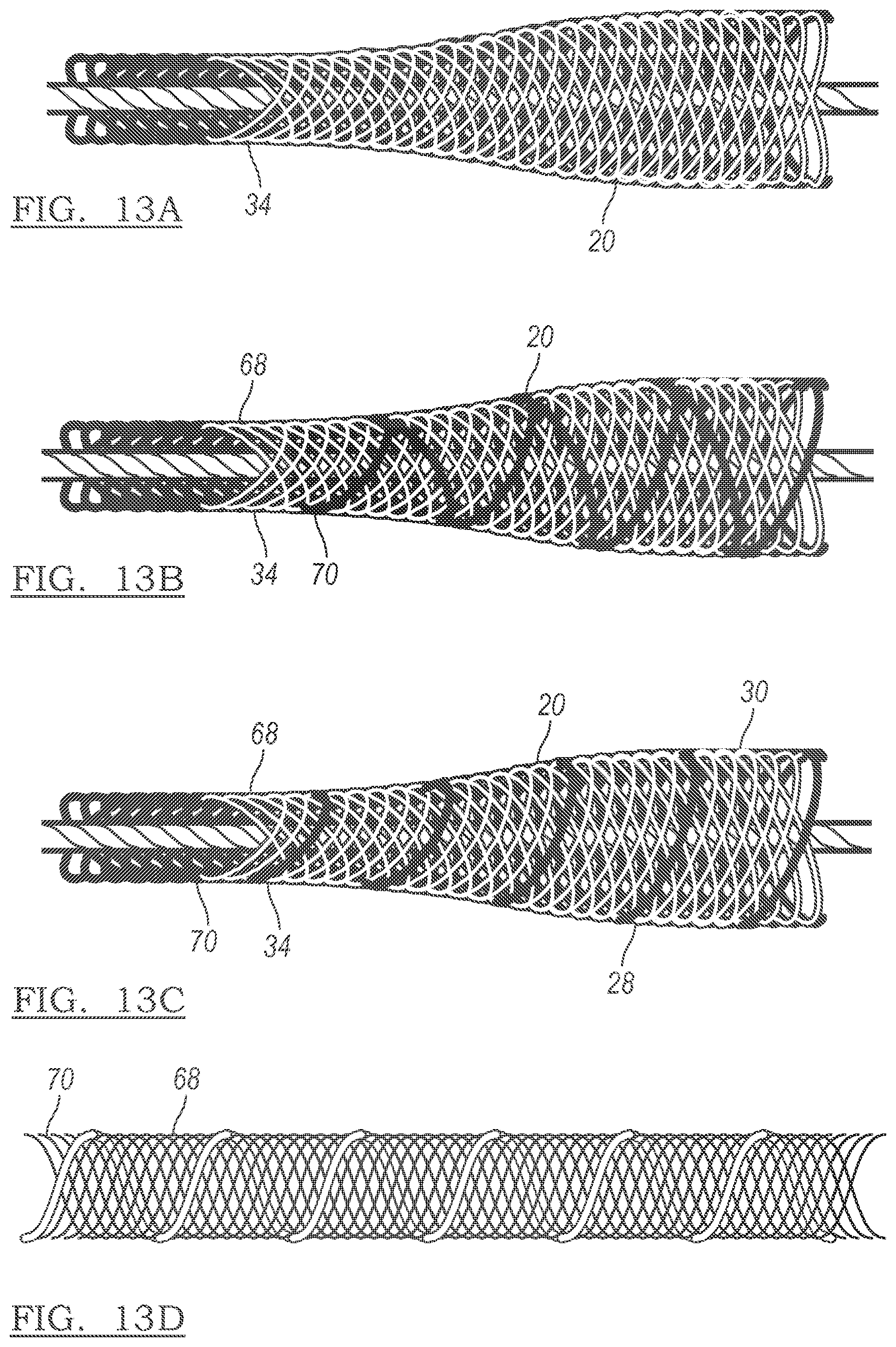 Patent US12096928 Figure 11 – Method and apparatus for coupling soft tissue to a bone
