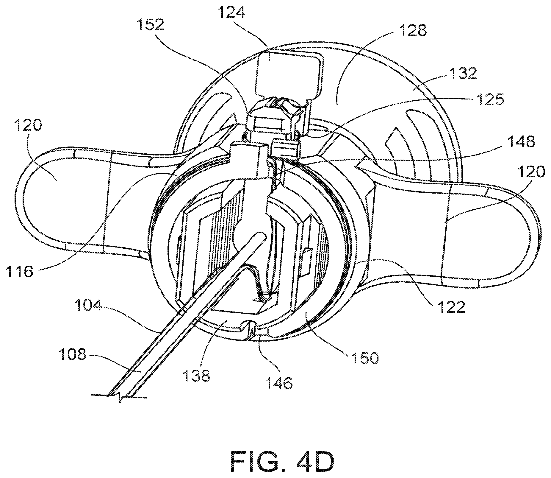 Patent US12096929 Figure 7 – Flexible anchor delivery system