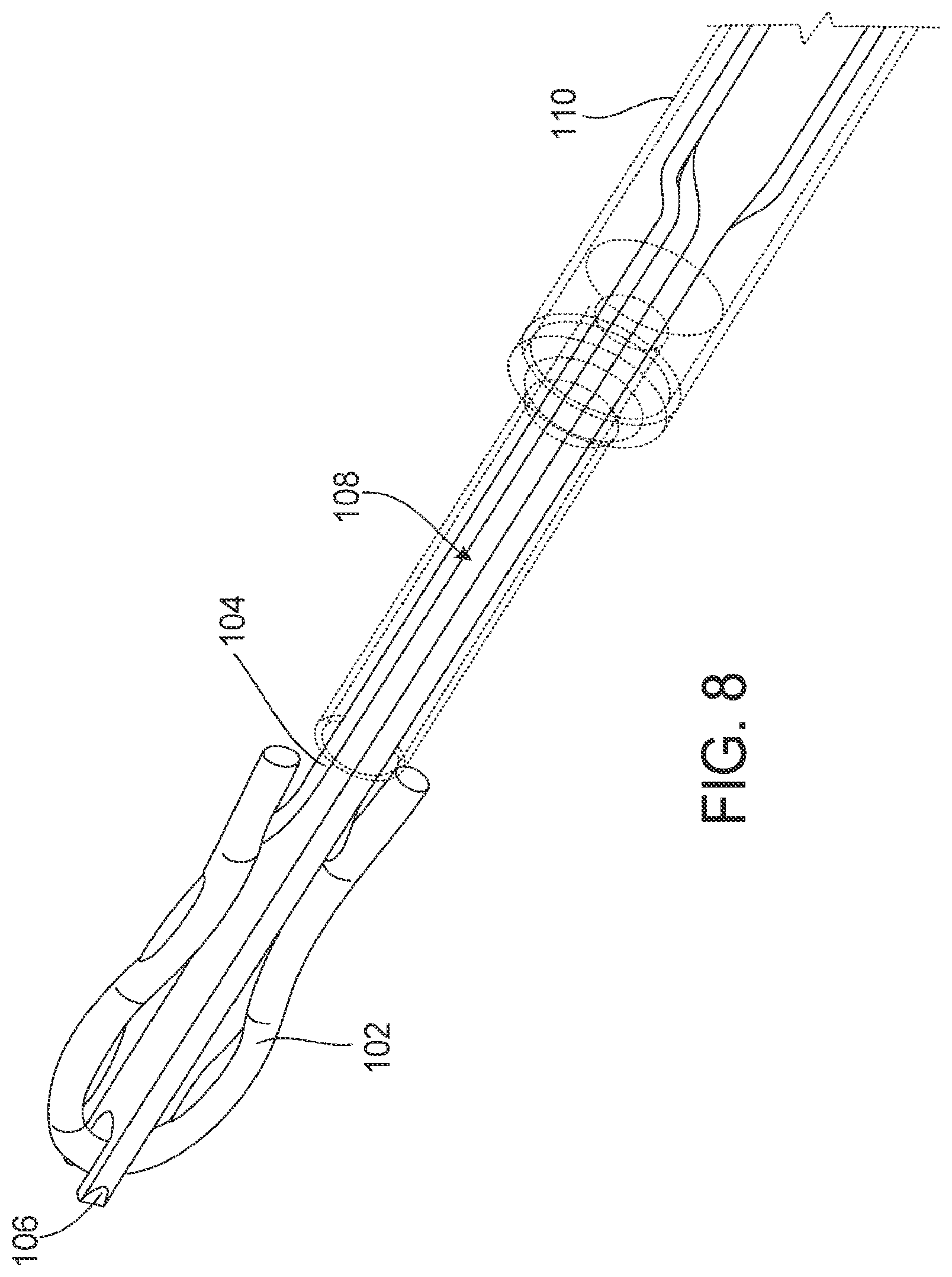 Patent US12096929 Figure 16 – Flexible anchor delivery system
