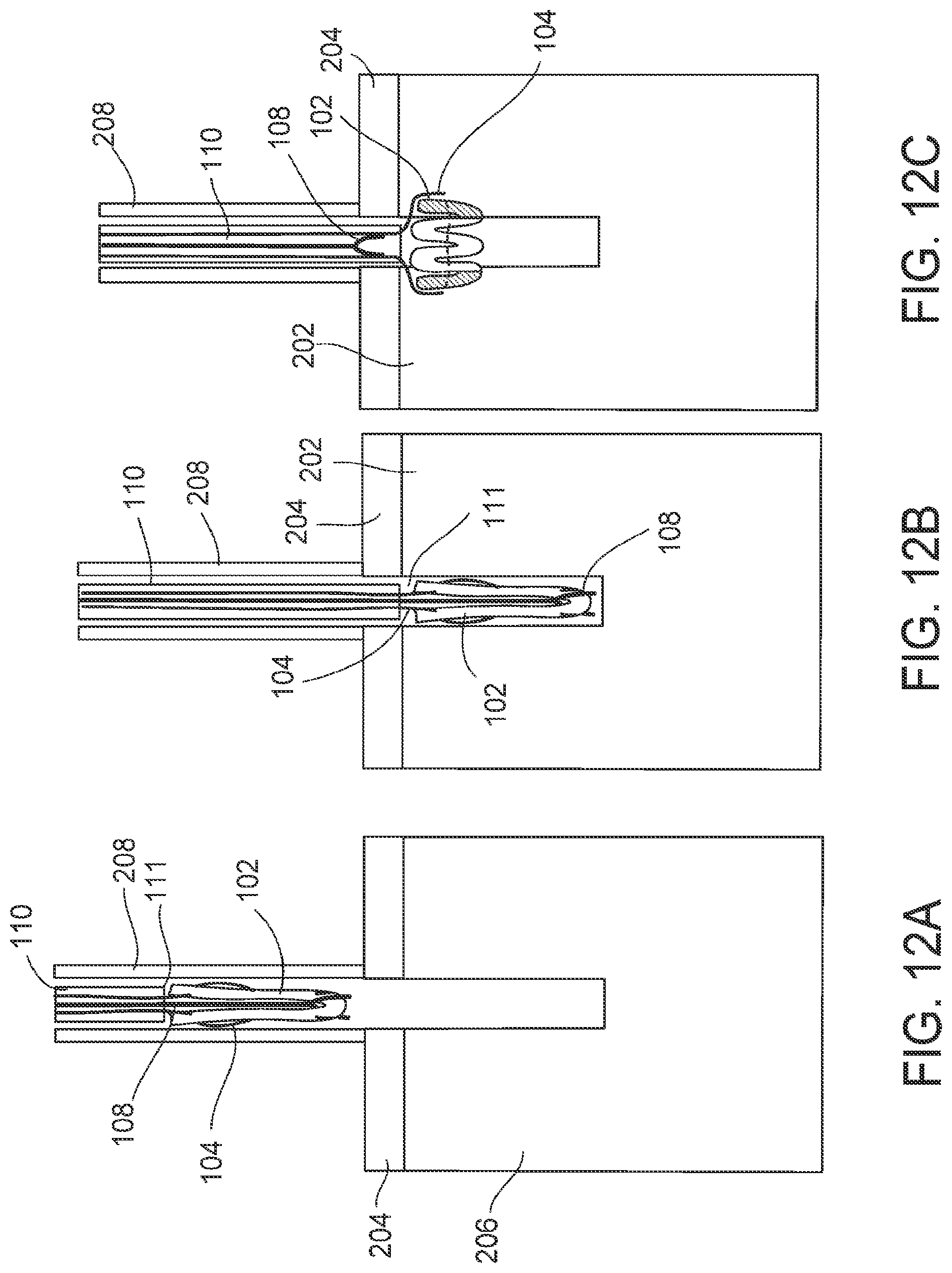 Patent US12096929 Figure 19 – Flexible anchor delivery system