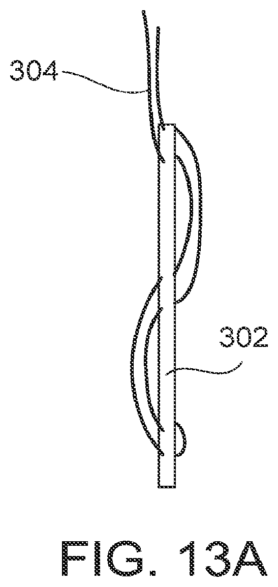 Patent US12096929 Figure 20 – Flexible anchor delivery system
