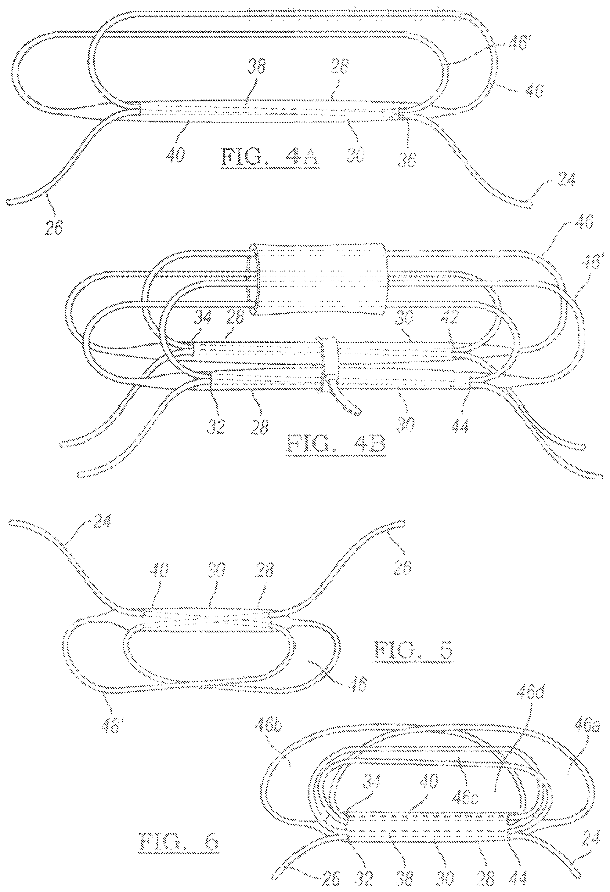 Patent US12096931 Figure 2 – Method and apparatus for coupling soft tissue to a bone