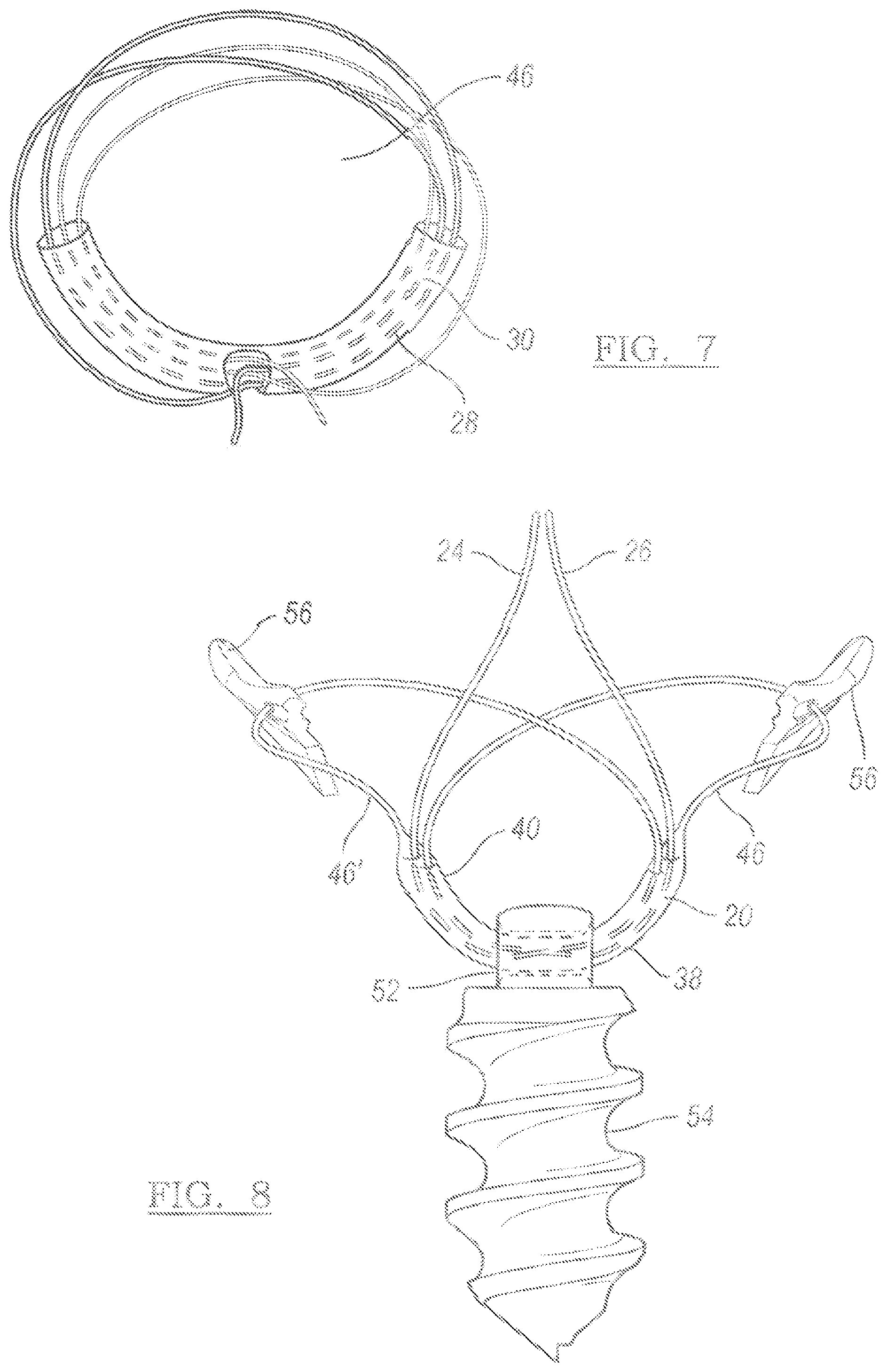 Patent US12096931 Figure 3 – Method and apparatus for coupling soft tissue to a bone