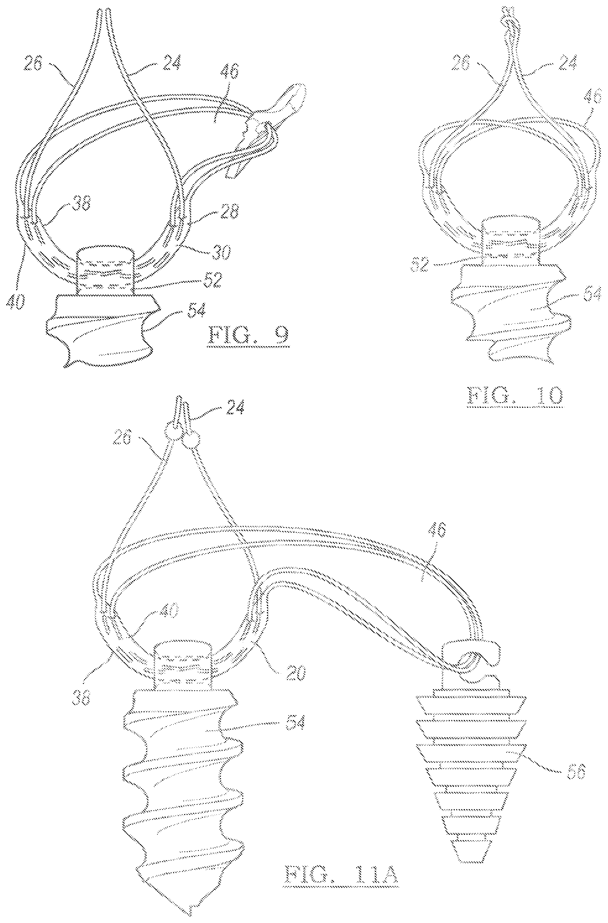 Patent US12096931 Figure 4 – Method and apparatus for coupling soft tissue to a bone
