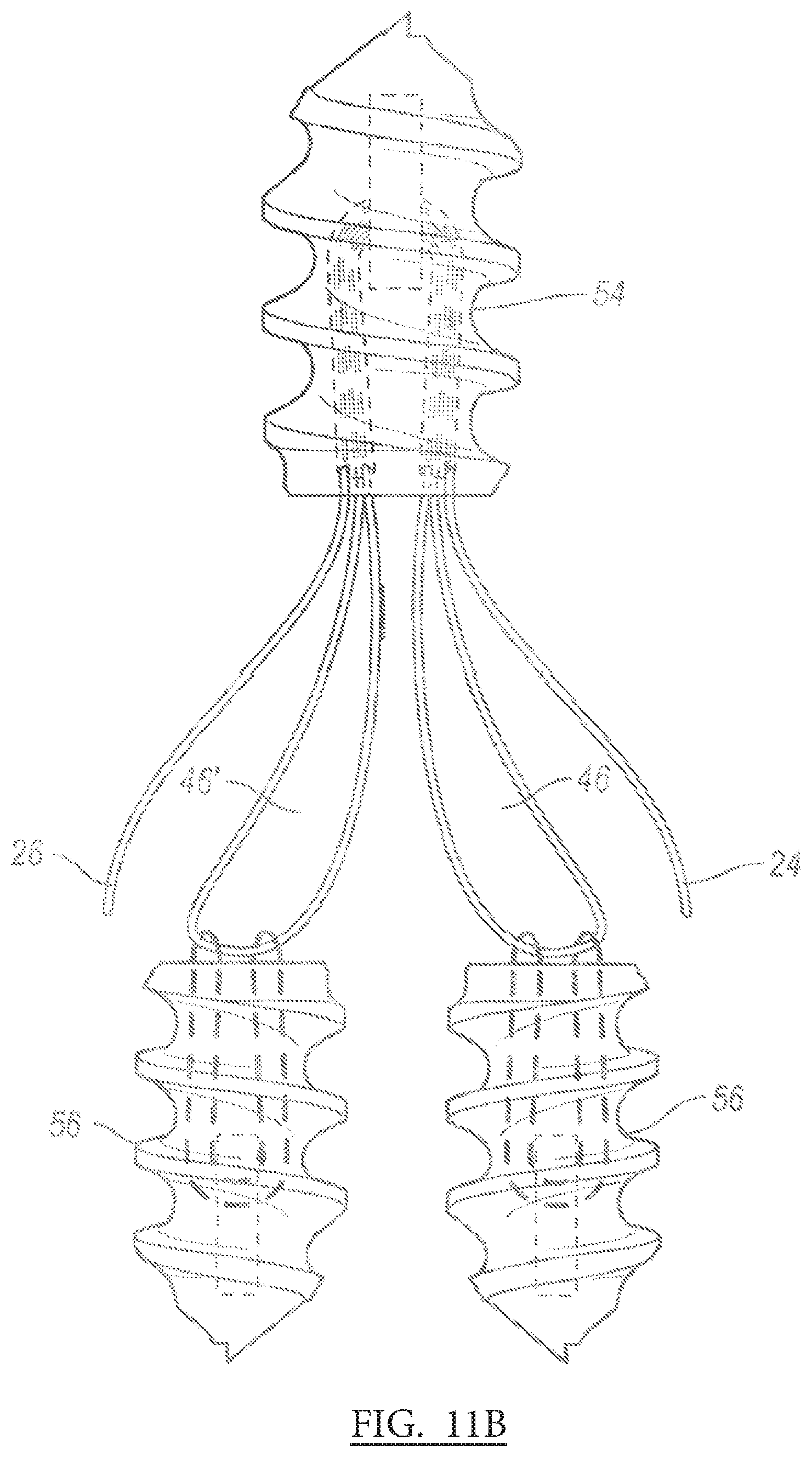 Patent US12096931 Figure 5 – Method and apparatus for coupling soft tissue to a bone