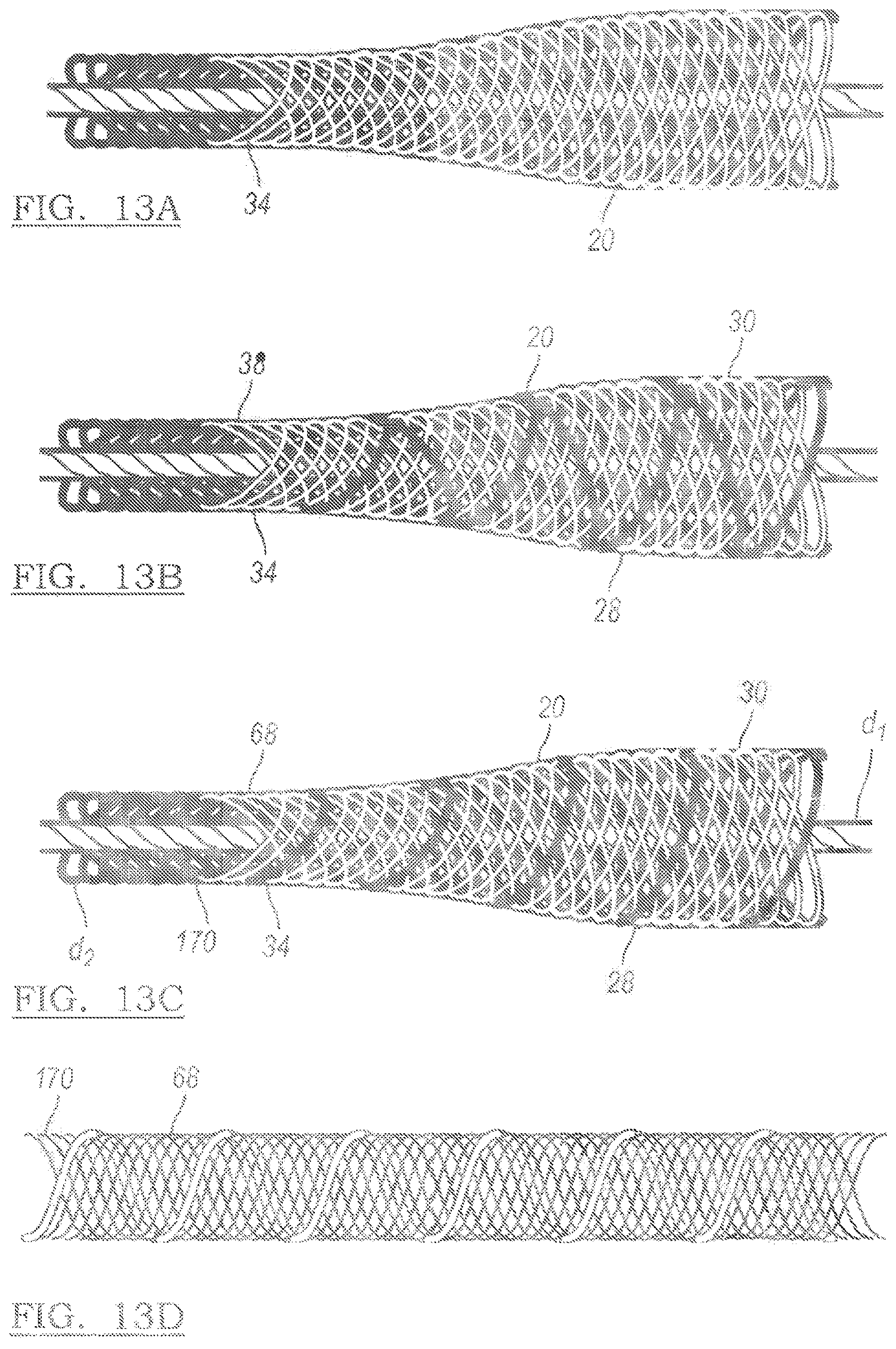 Patent US12096931 Figure 11 – Method and apparatus for coupling soft tissue to a bone