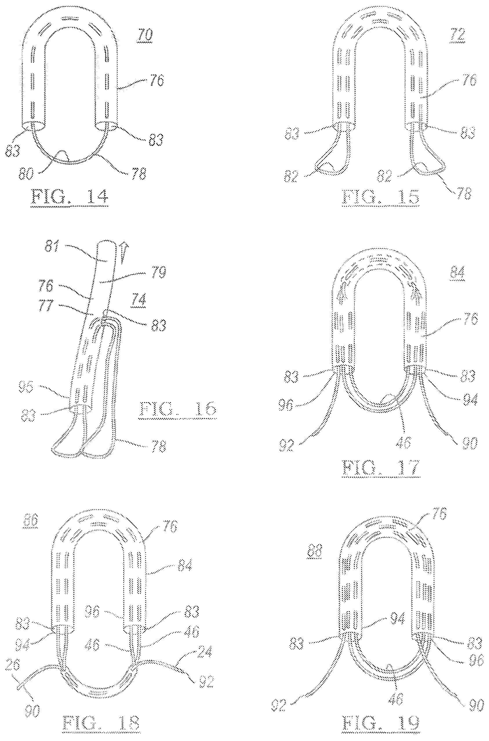 Patent US12096931 Figure 12 – Method and apparatus for coupling soft tissue to a bone