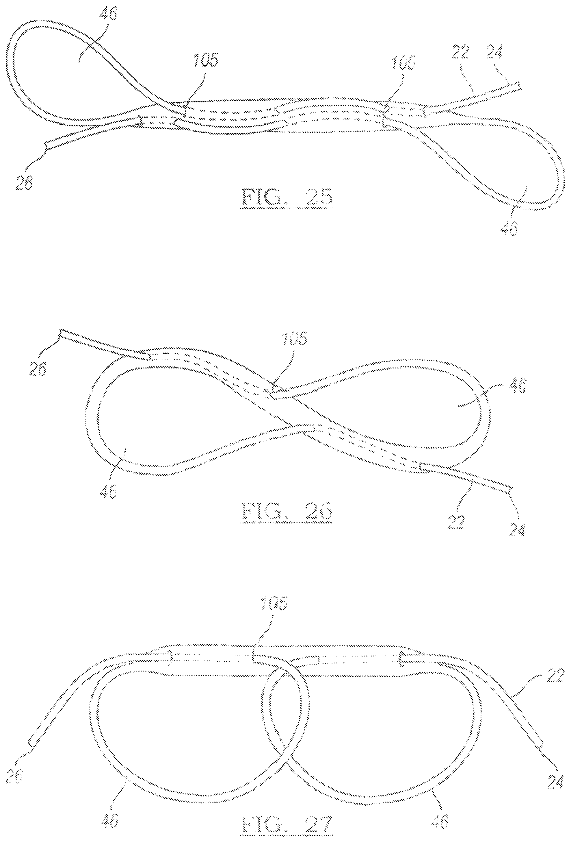 Patent US12096931 Figure 15 – Method and apparatus for coupling soft tissue to a bone