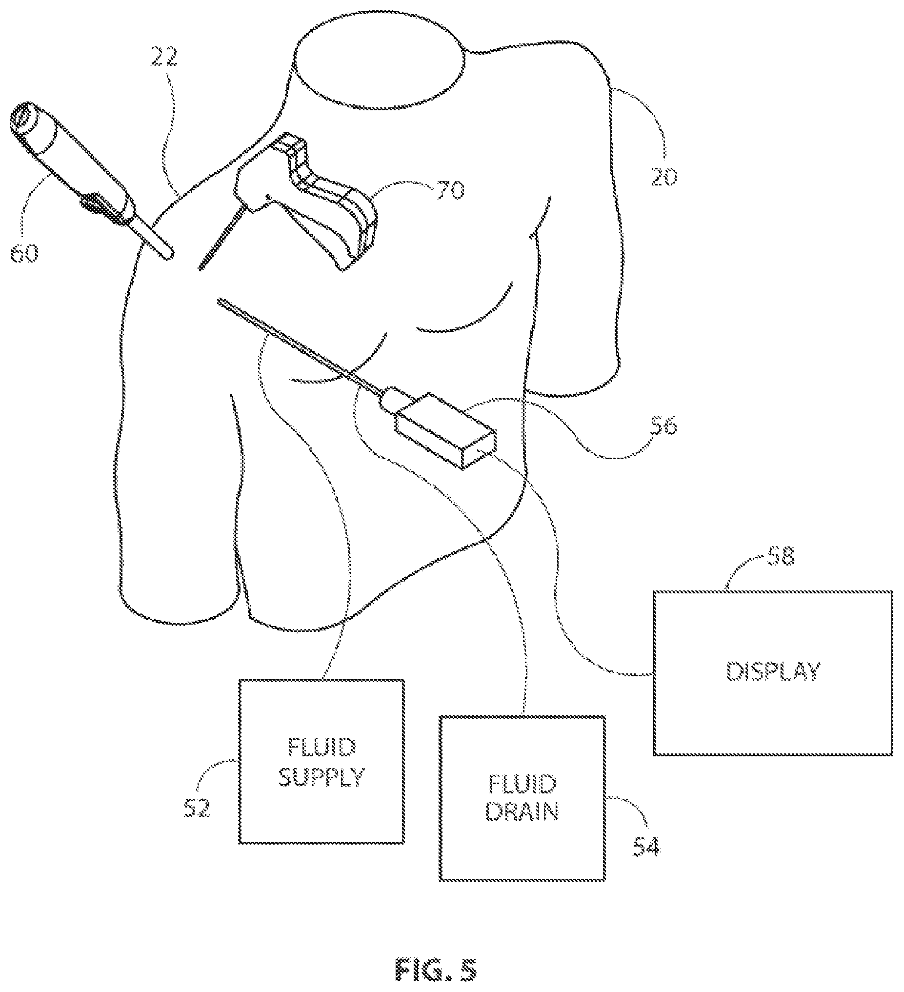 Patent US12096932 Figure 4 – Medical implant delivery system and related methods