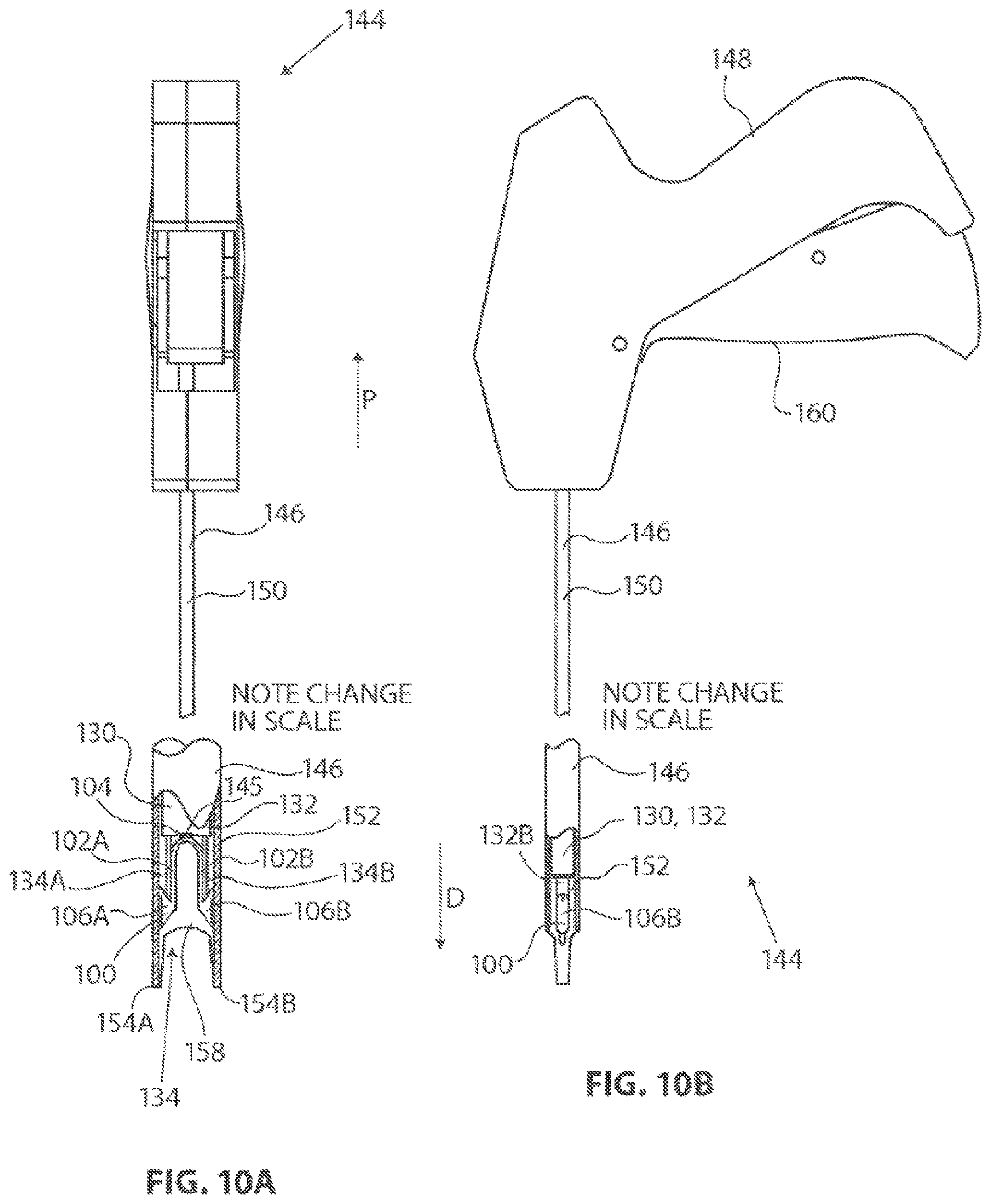 Patent US12096932 Figure 9 – Medical implant delivery system and related methods