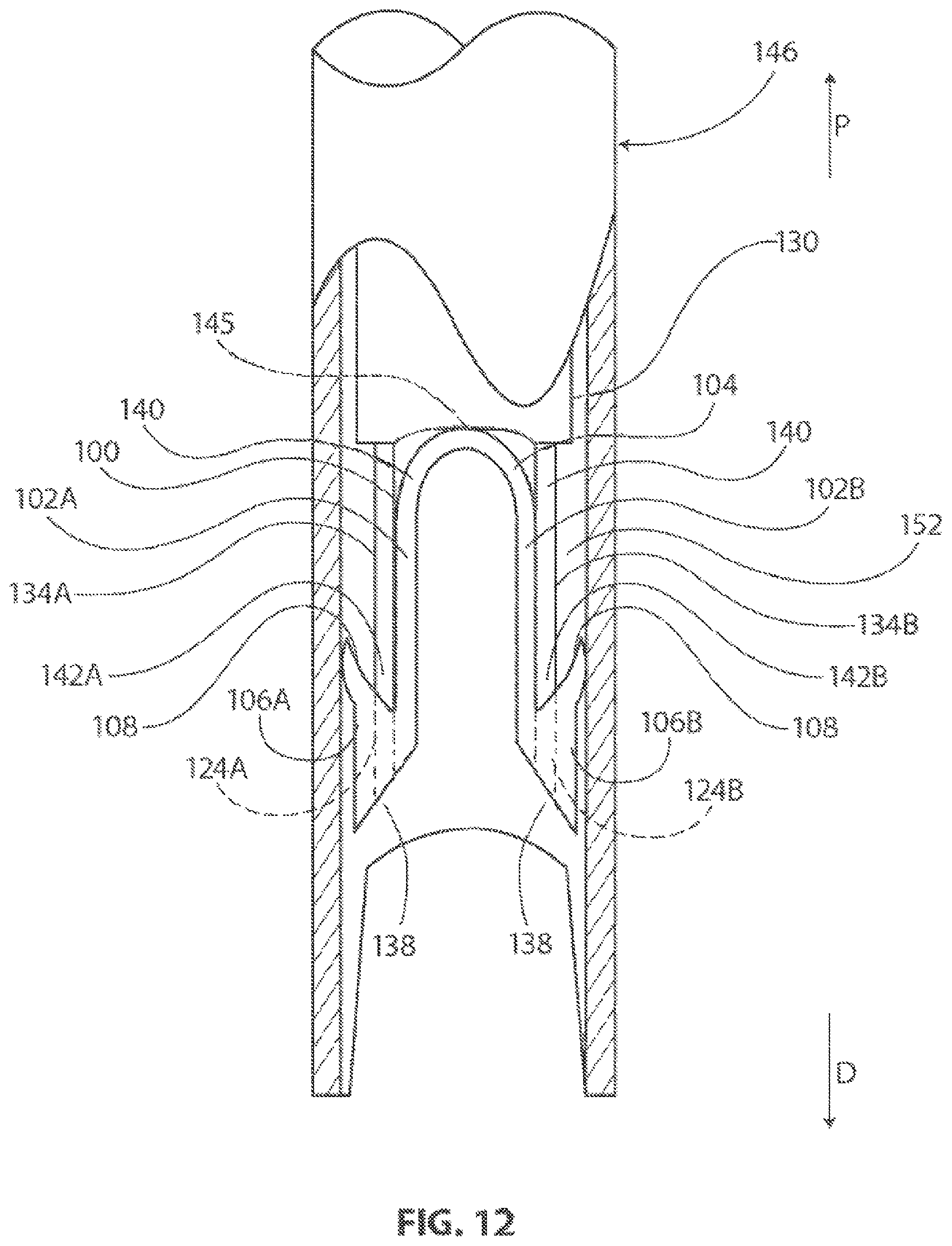 Patent US12096932 Figure 11 – Medical implant delivery system and related methods