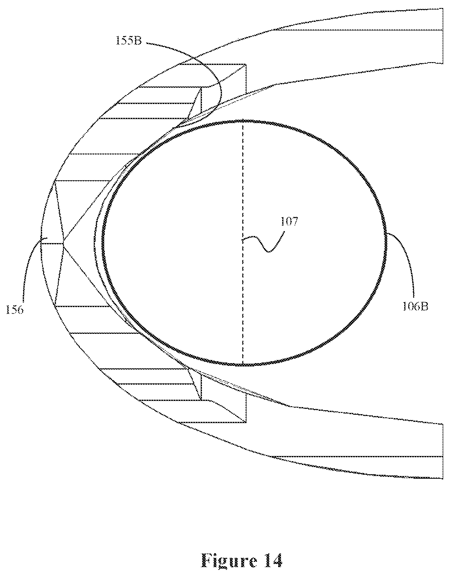 Patent US12096932 Figure 13 – Medical implant delivery system and related methods