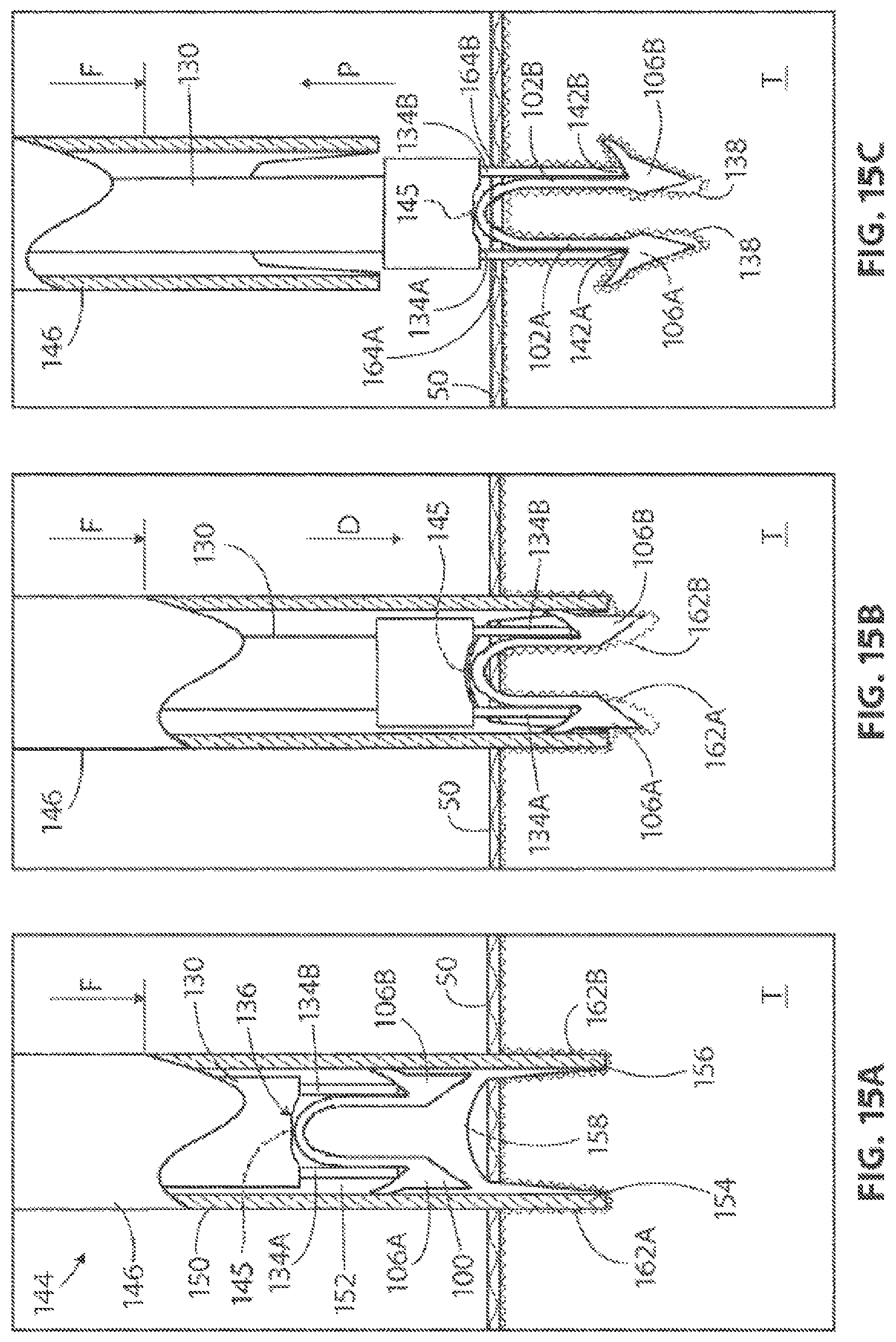 Patent US12096932 Figure 14 – Medical implant delivery system and related methods