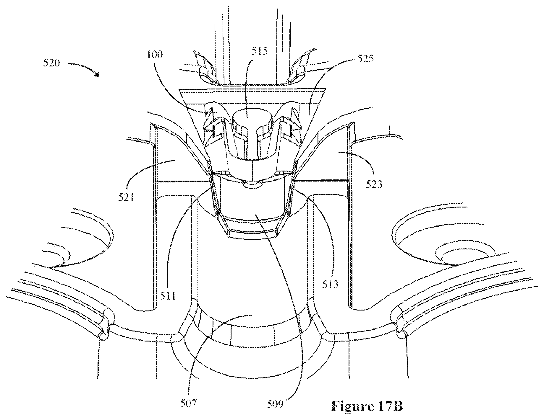 Patent US12096932 Figure 17 – Medical implant delivery system and related methods