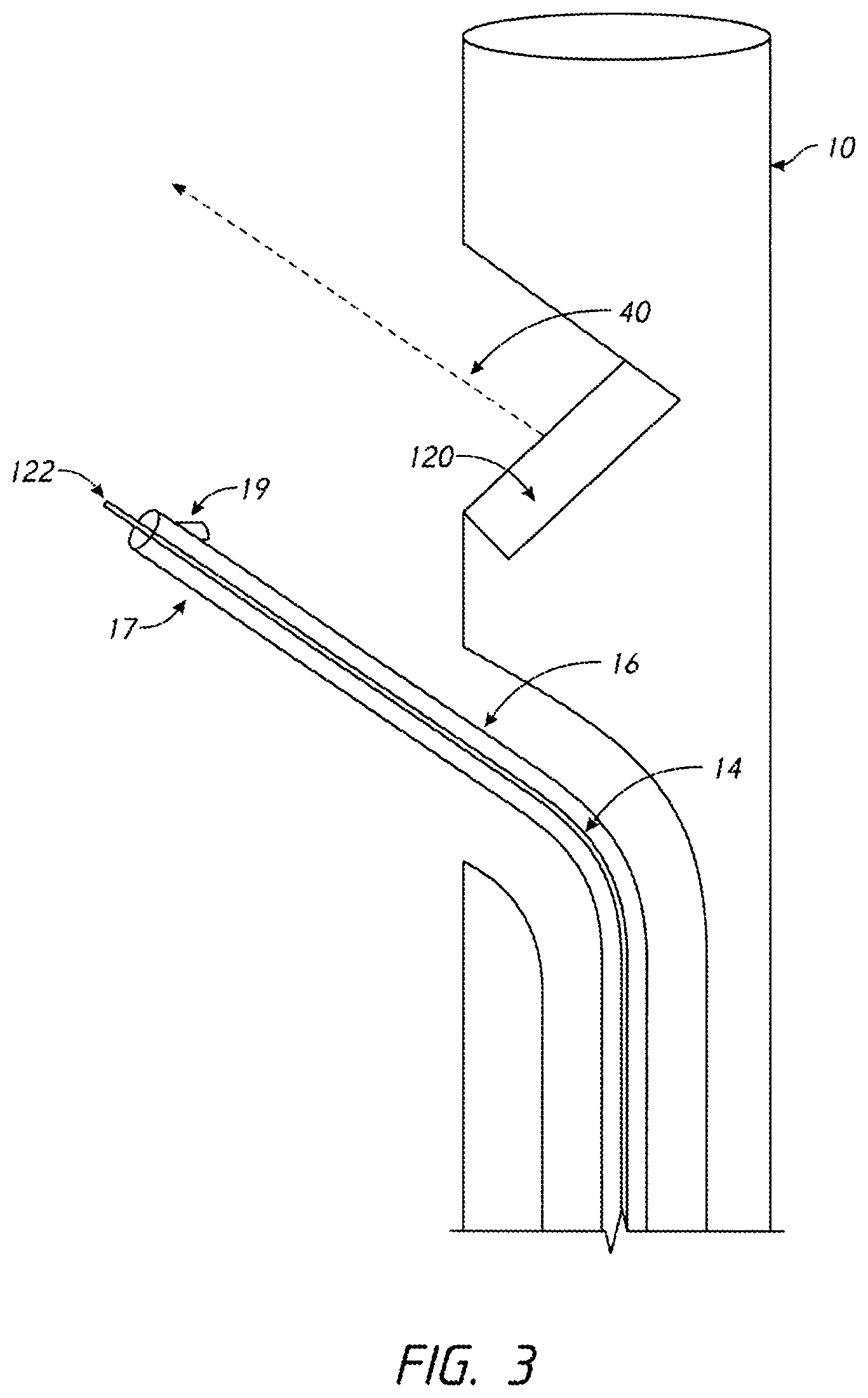 Patent US12096938 Figure 3 – Devices and methods for increasing blood perfusion to a distal extremity