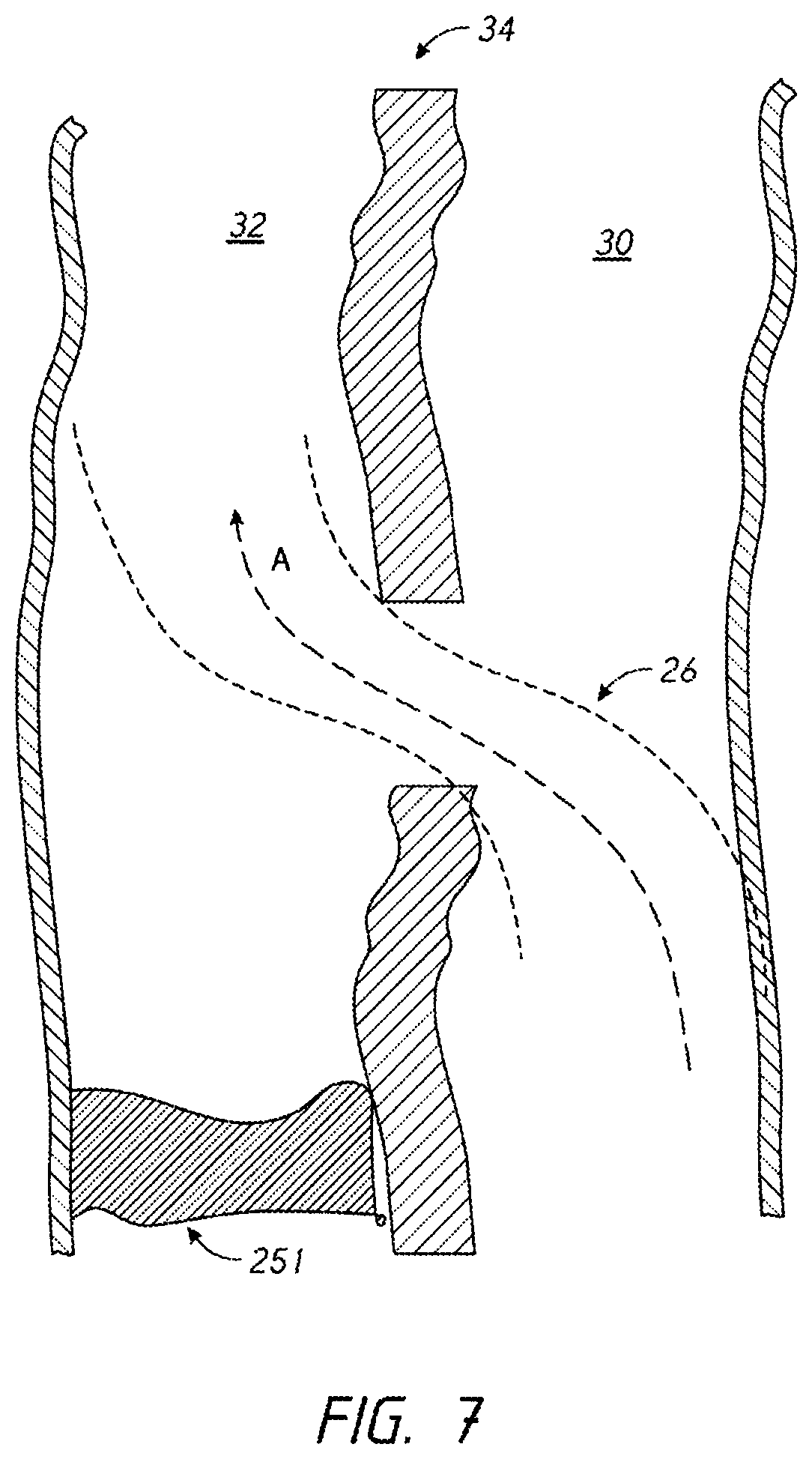Patent US12096938 Figure 7 – Devices and methods for increasing blood perfusion to a distal extremity