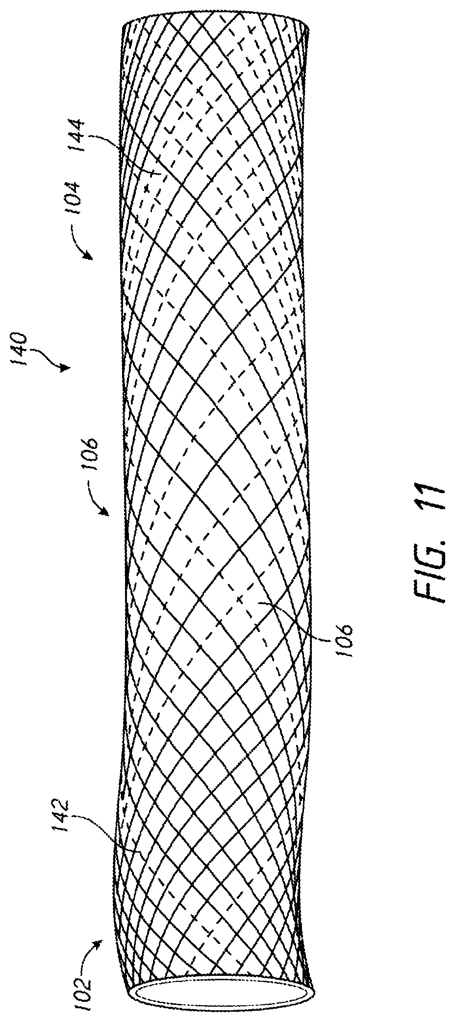 Patent US12096938 Figure 11 – Devices and methods for increasing blood perfusion to a distal extremity