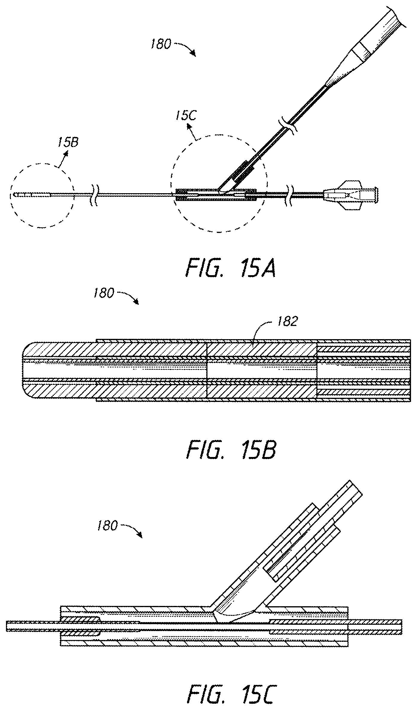 Patent US12096938 Figure 15 – Devices and methods for increasing blood perfusion to a distal extremity