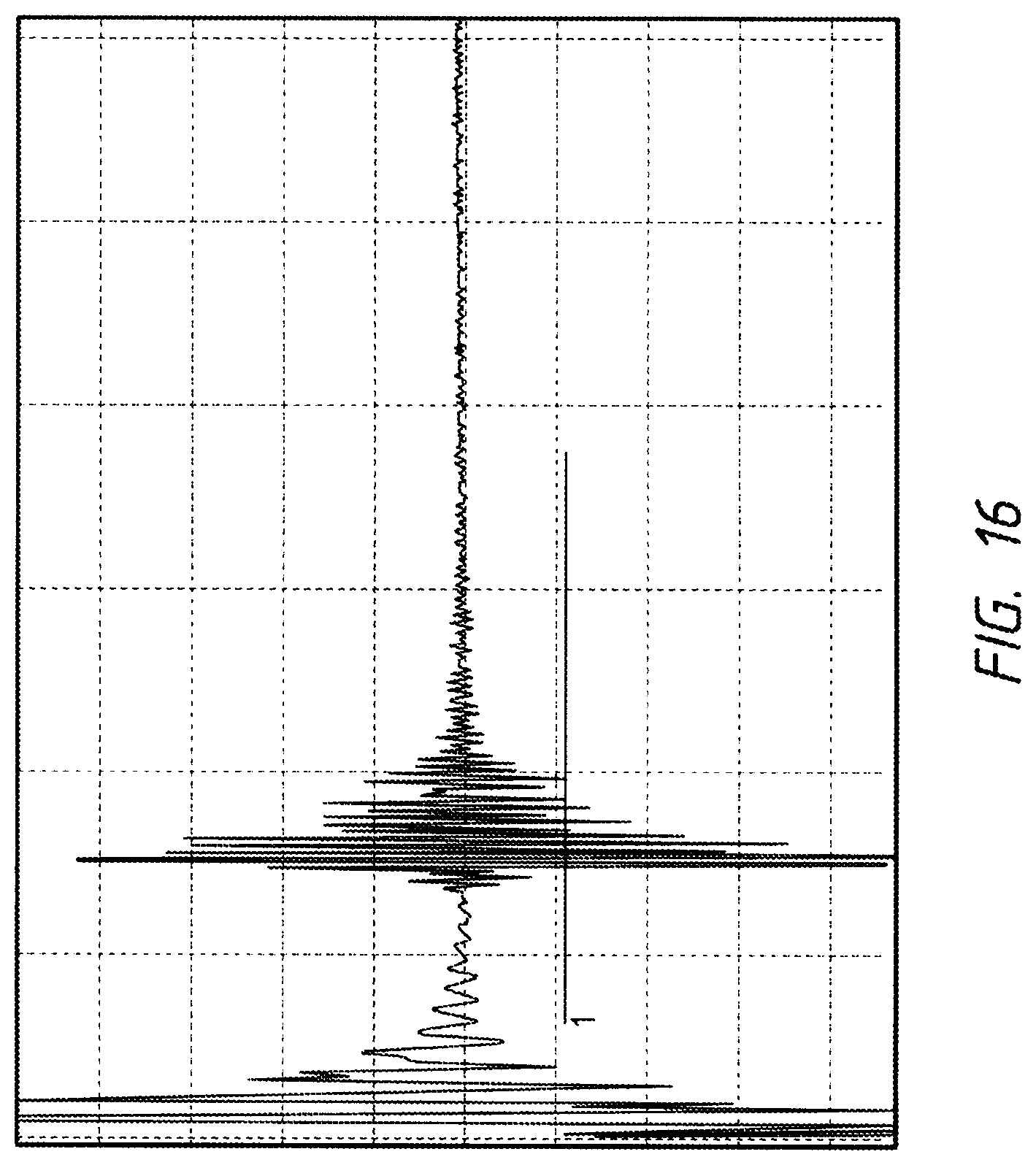 Patent US12096938 Figure 16 – Devices and methods for increasing blood perfusion to a distal extremity