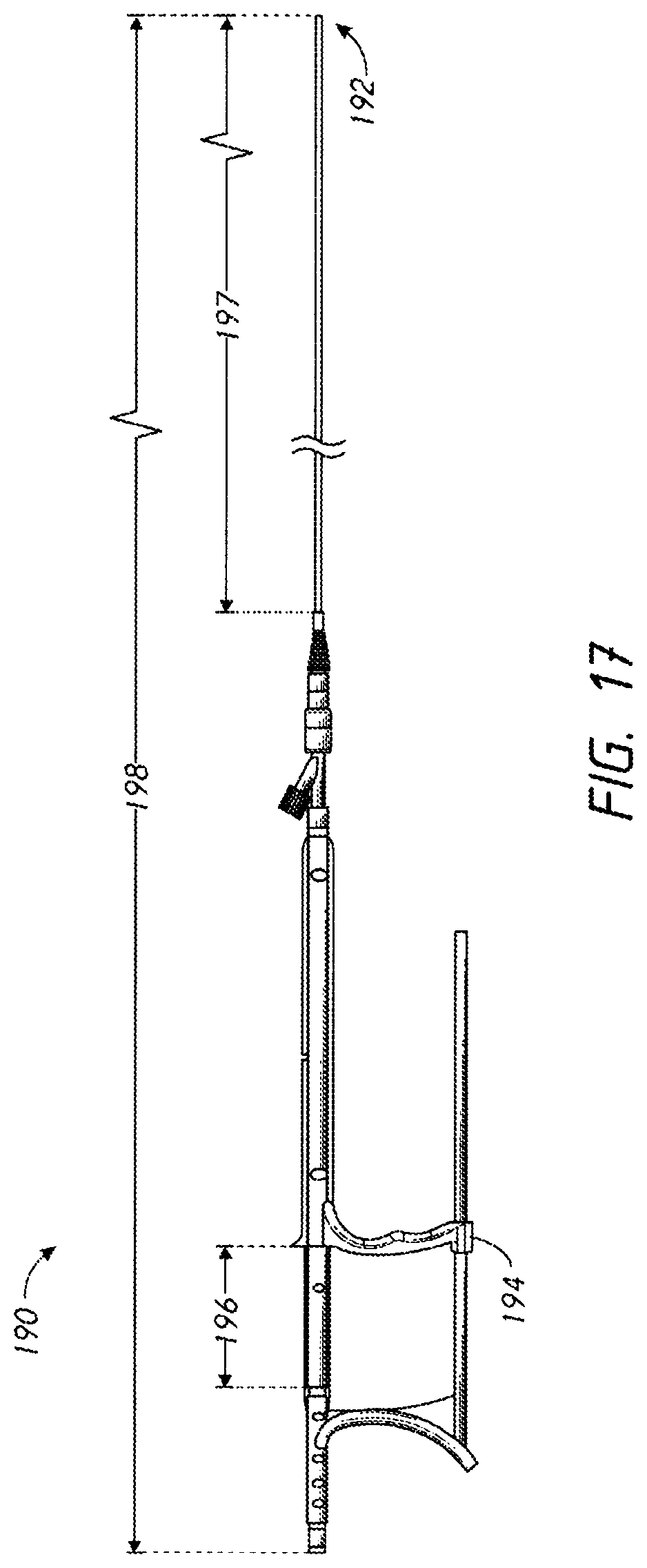 Patent US12096938 Figure 17 – Devices and methods for increasing blood perfusion to a distal extremity