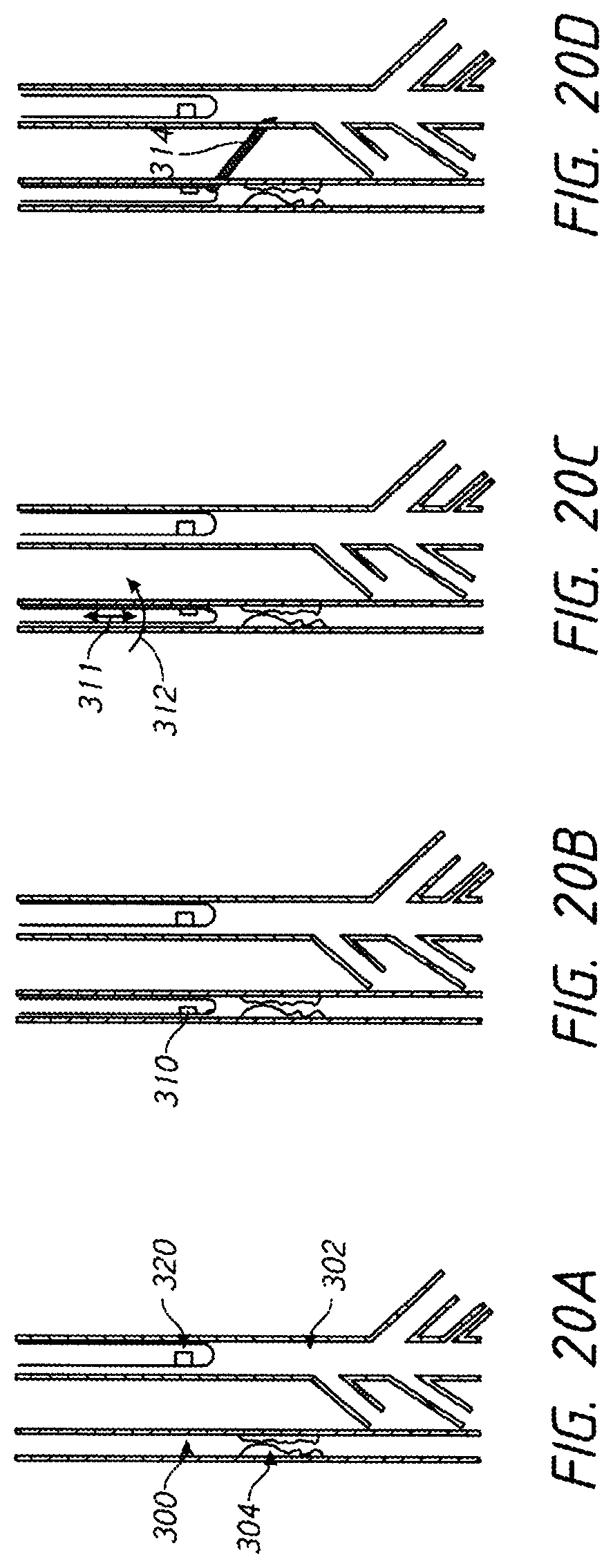 Patent US12096938 Figure 20 – Devices and methods for increasing blood perfusion to a distal extremity