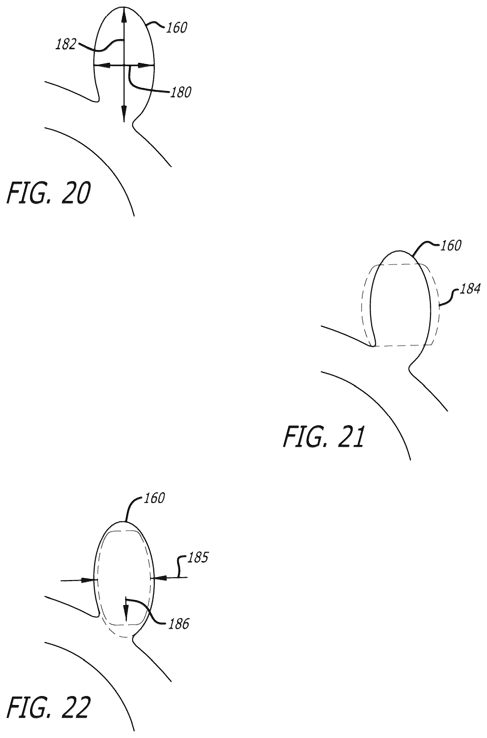 Patent US12096940 Figure 14 – Filamentary devices for treatment of vascular defects