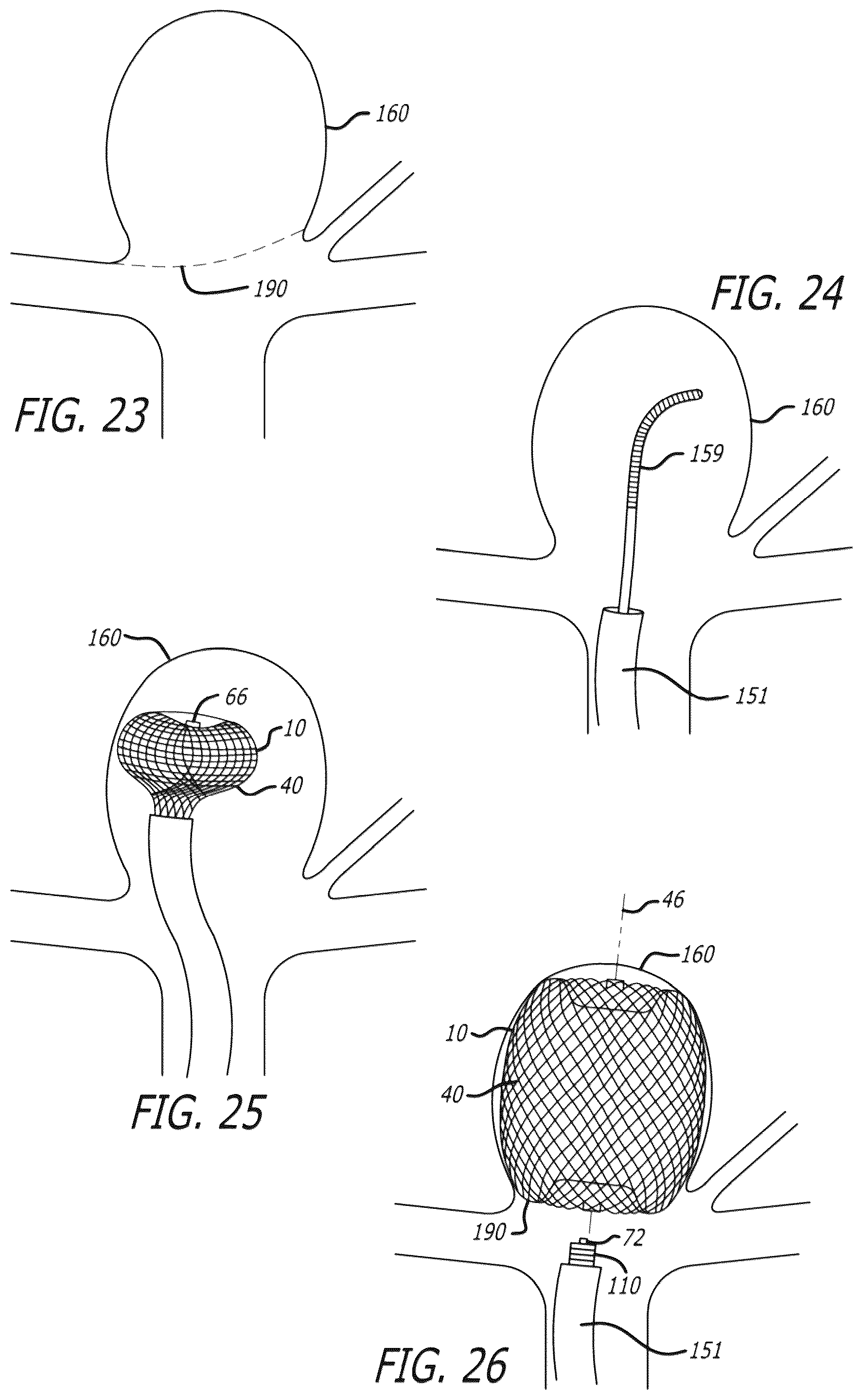 Patent US12096940 Figure 15 – Filamentary devices for treatment of vascular defects