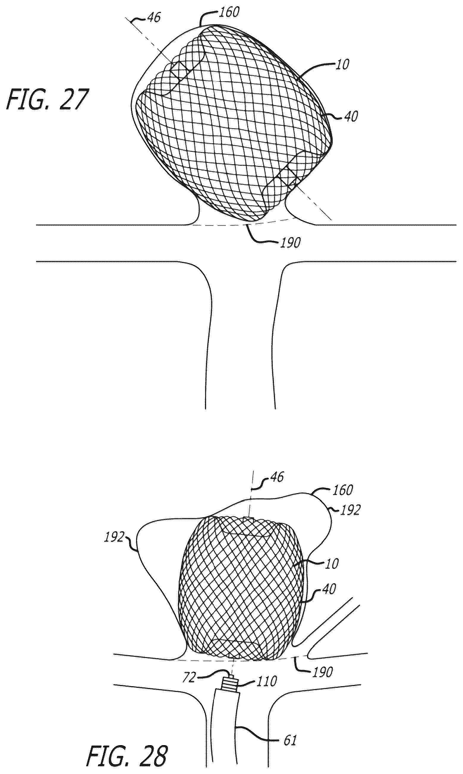 Patent US12096940 Figure 16 – Filamentary devices for treatment of vascular defects