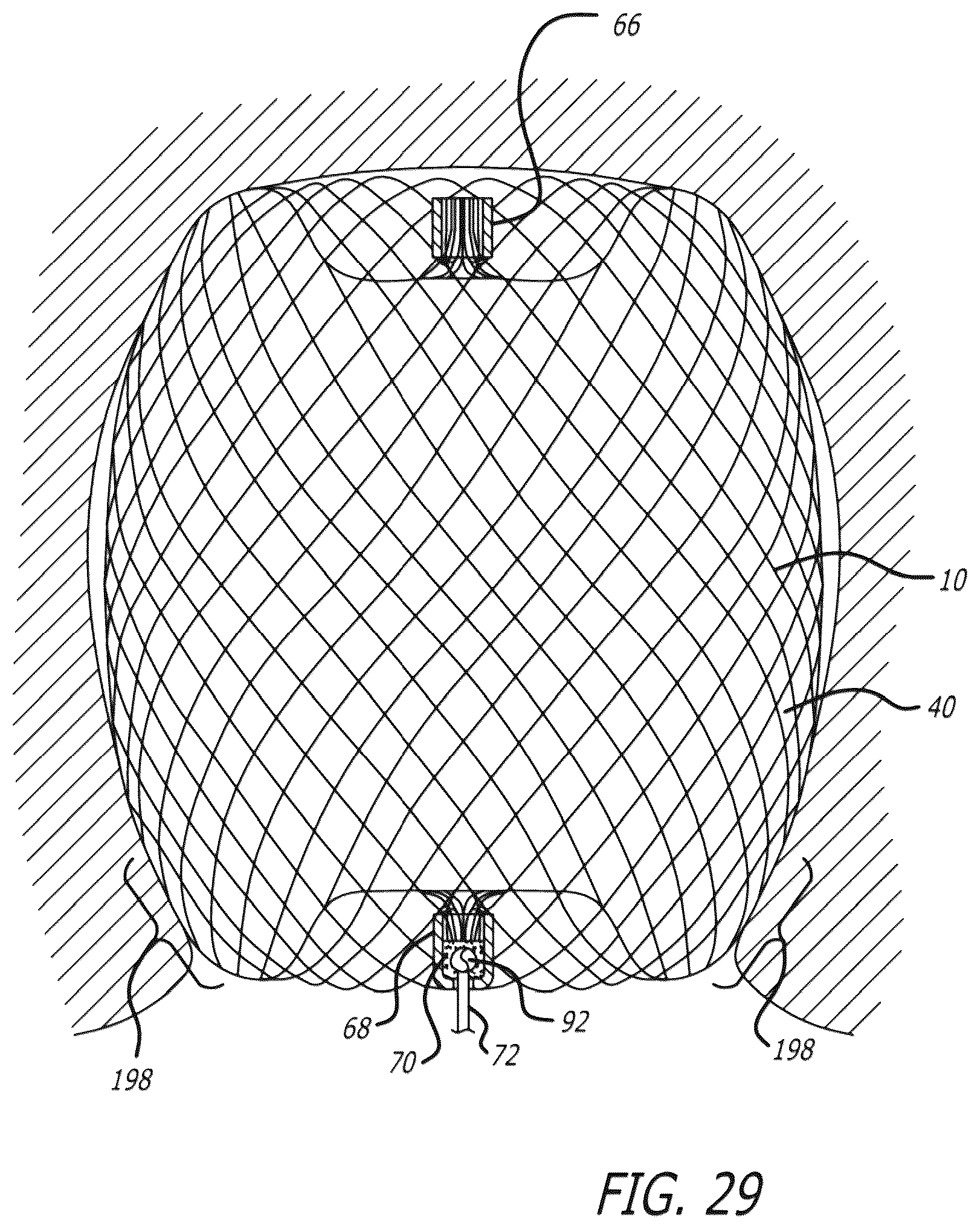 Patent US12096940 Figure 17 – Filamentary devices for treatment of vascular defects
