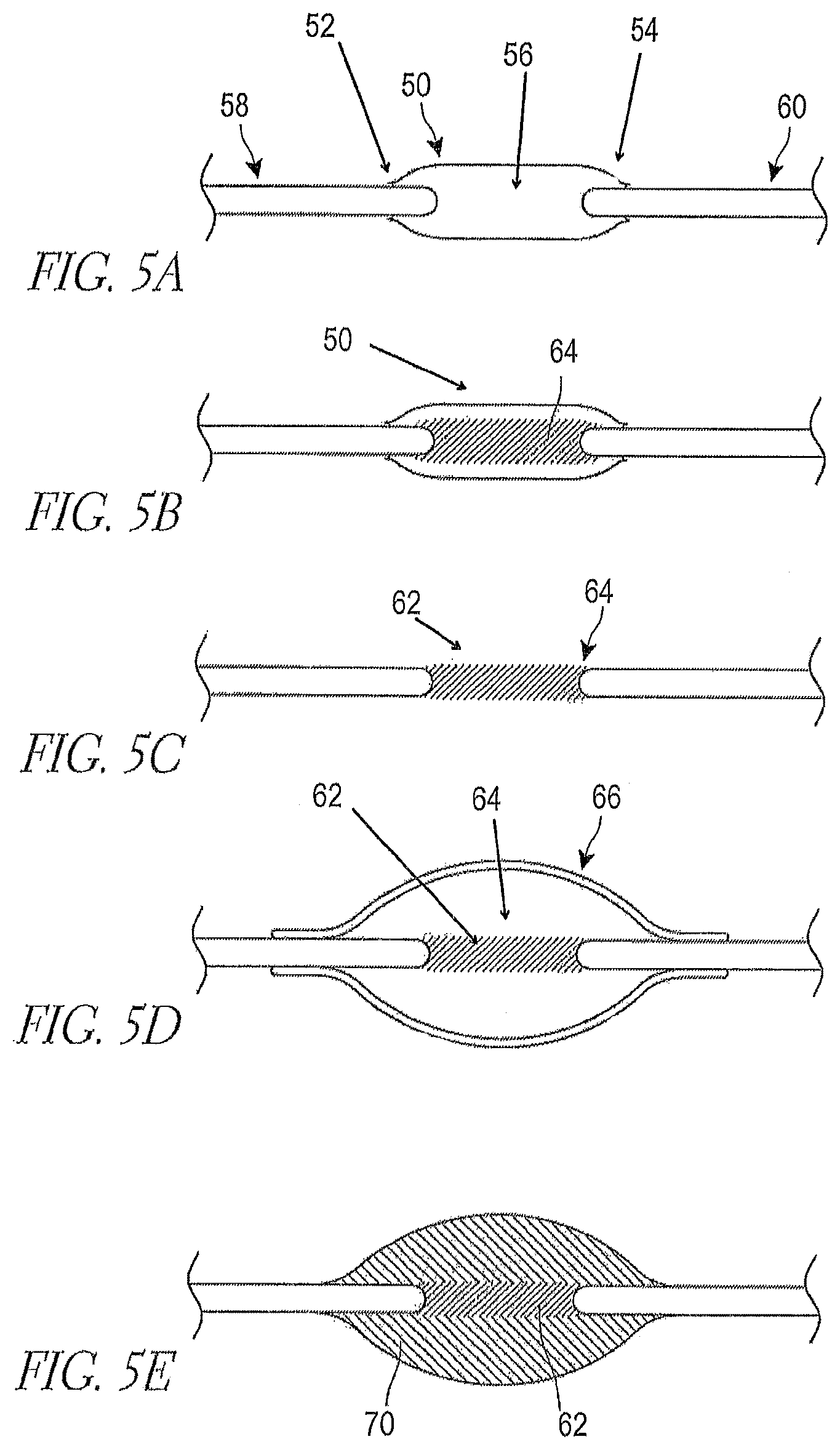 Patent US12096941 Figure 9 – Methods for forming a nerve barrier