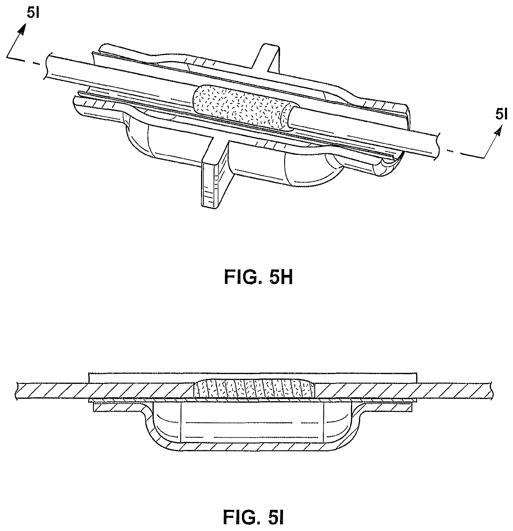 Patent US12096941 Figure 11 – Methods for forming a nerve barrier