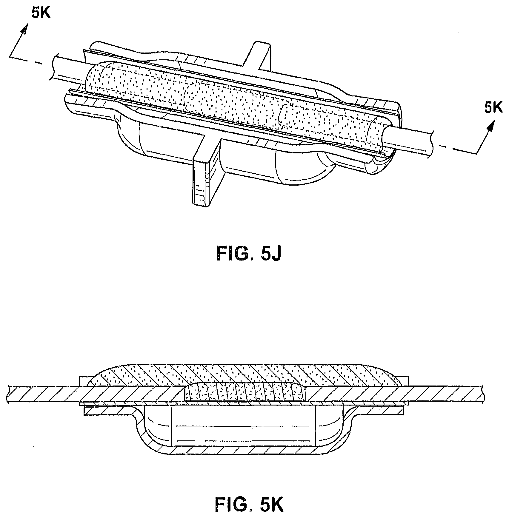 Patent US12096941 Figure 12 – Methods for forming a nerve barrier