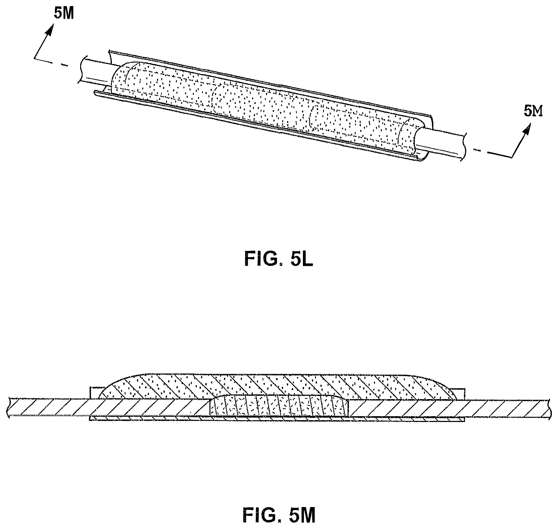 Patent US12096941 Figure 13 – Methods for forming a nerve barrier