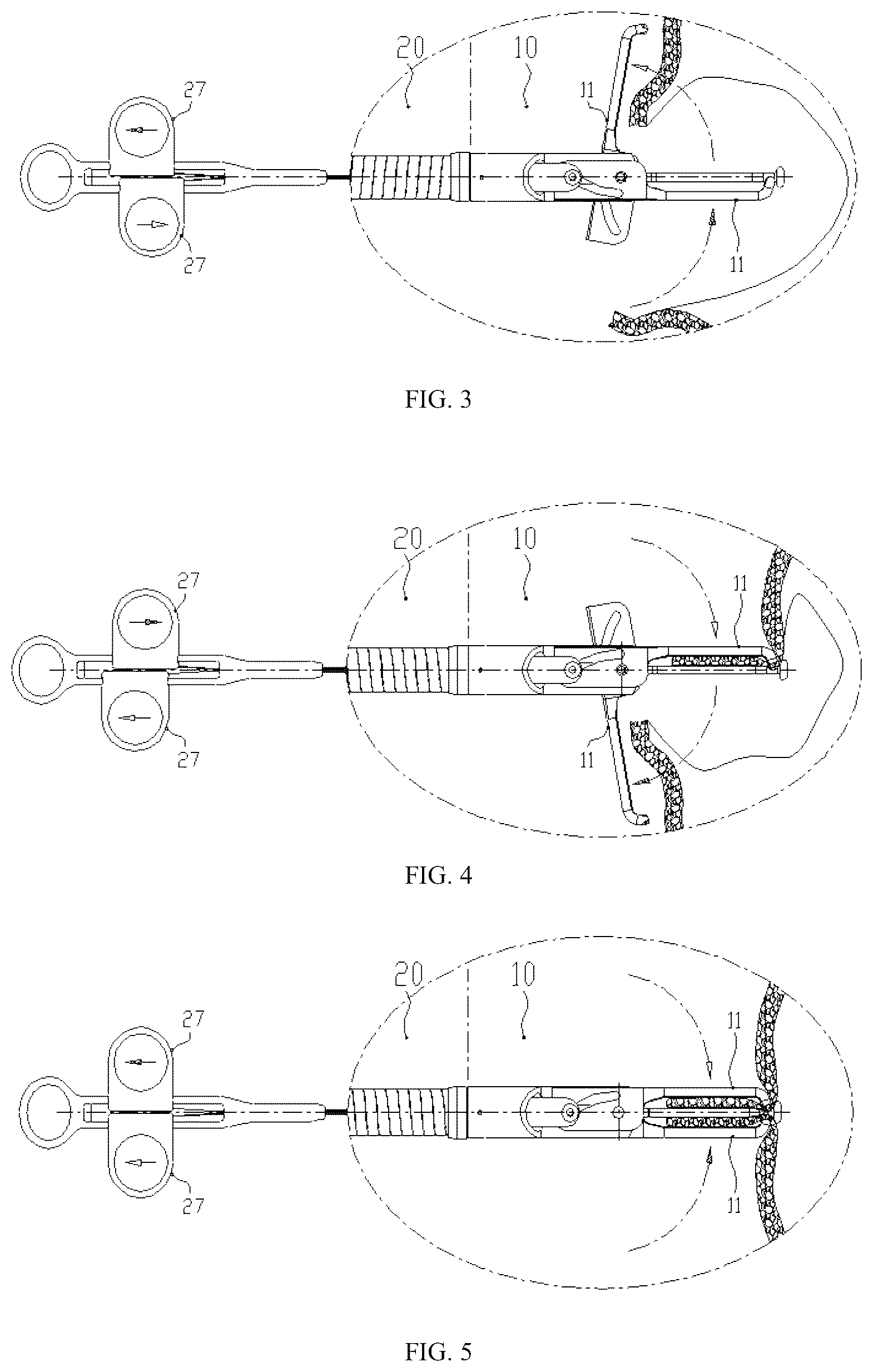 Patent US12096942 Figure 2 – Hemostasis and suturing conjoined dual-clamp capable of passing through channel of digestive endoscope and operation method