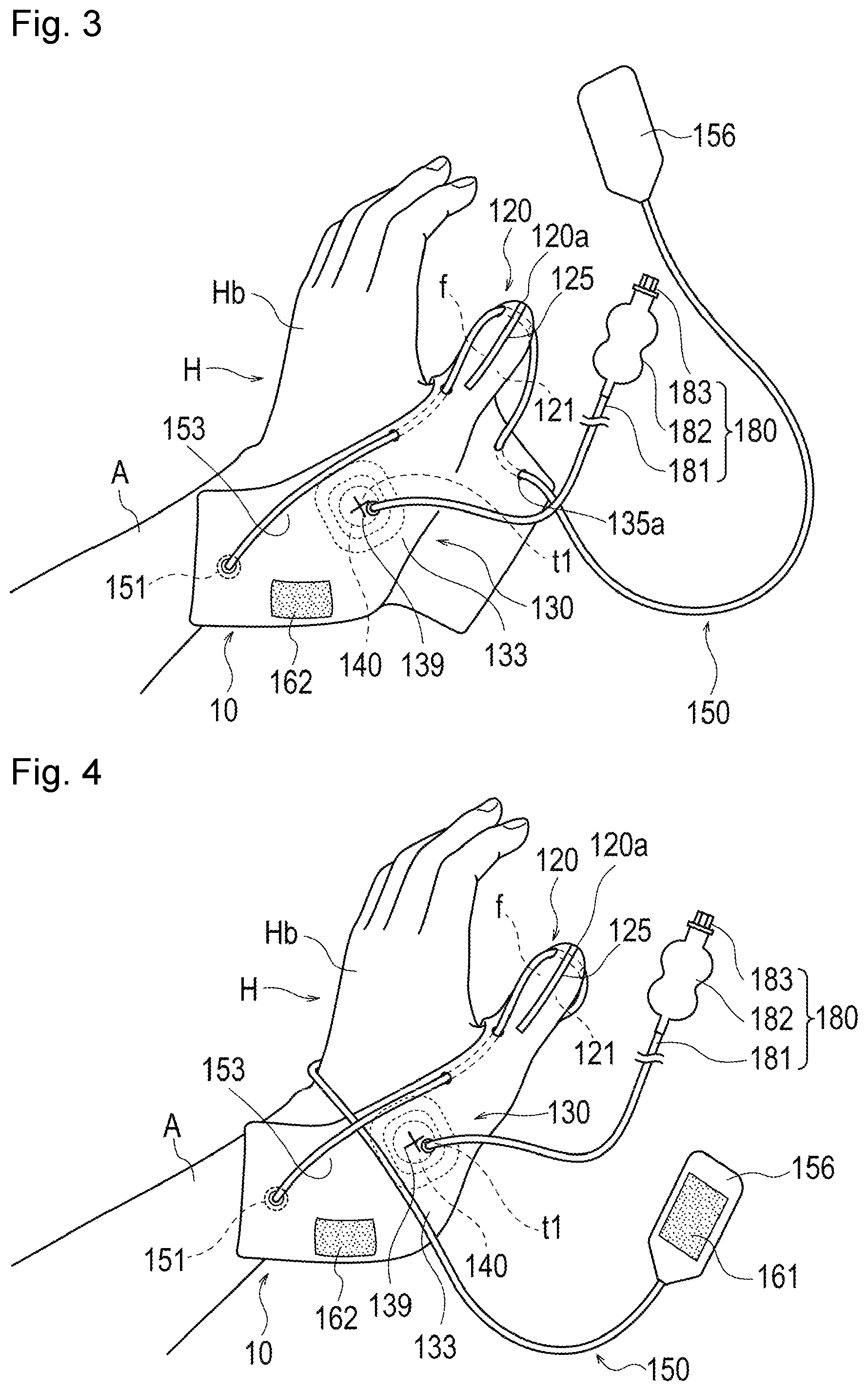 Patent US12096944 Figure 3 – Hemostatic device