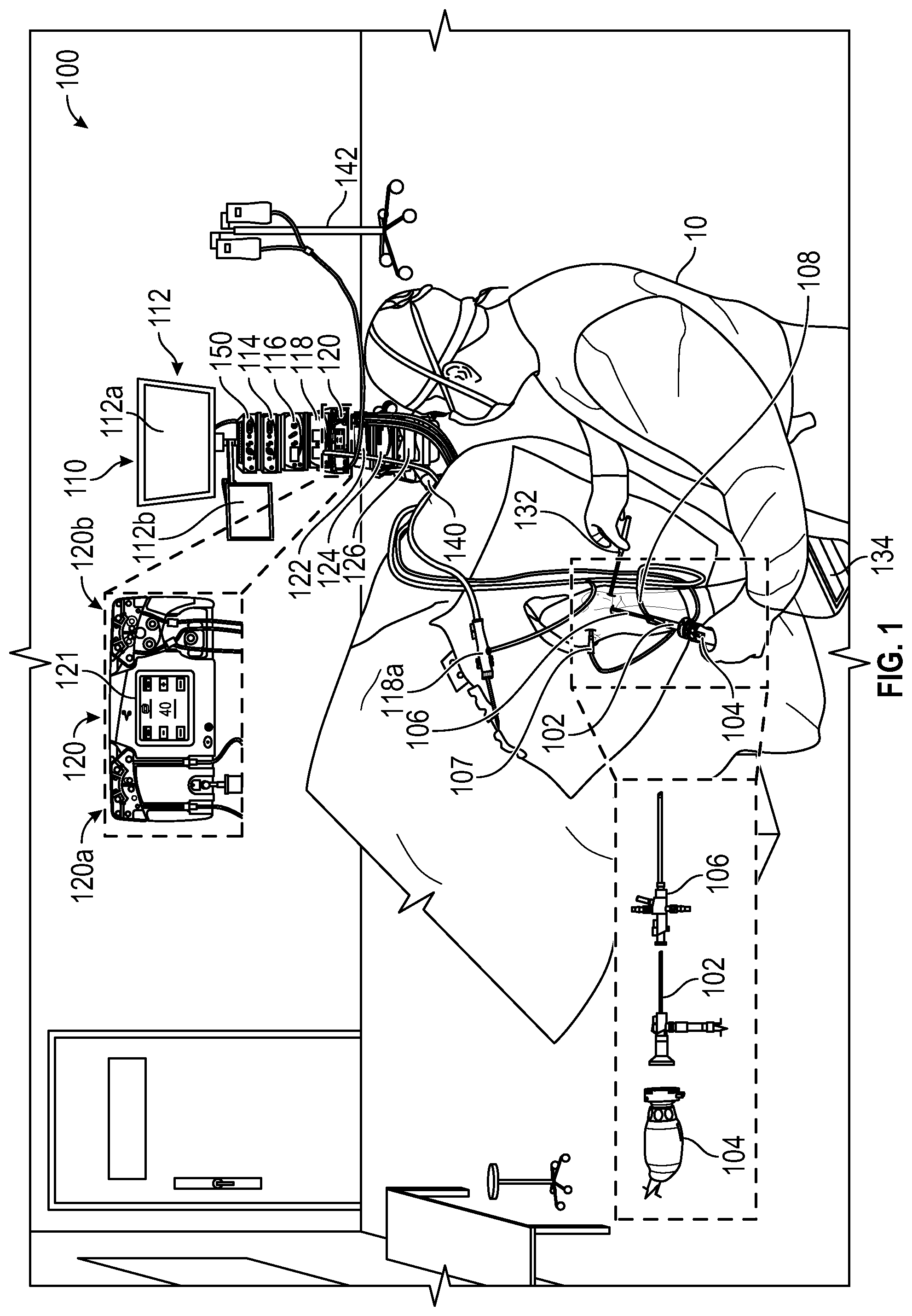 Patent US12096945 Figure 1 – Systems and devices for endoscopic procedure analysis based on state data