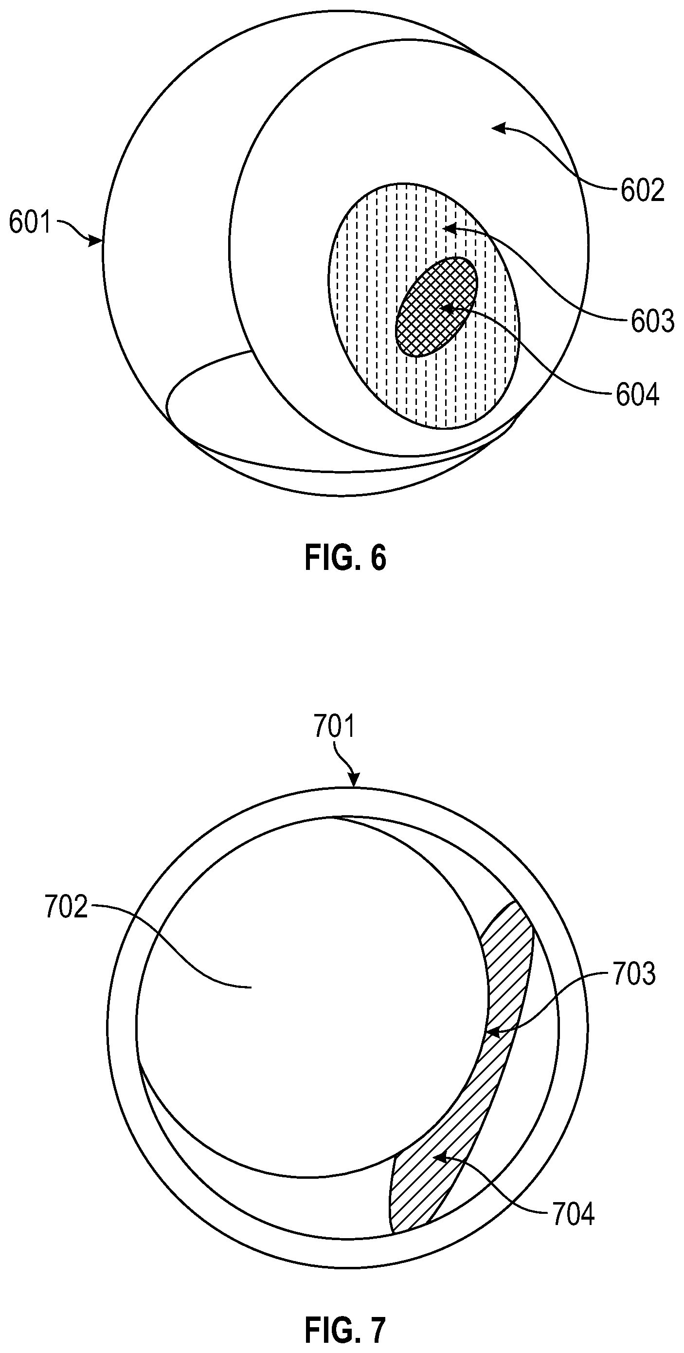 Patent US12096945 Figure 6 – Systems and devices for endoscopic procedure analysis based on state data