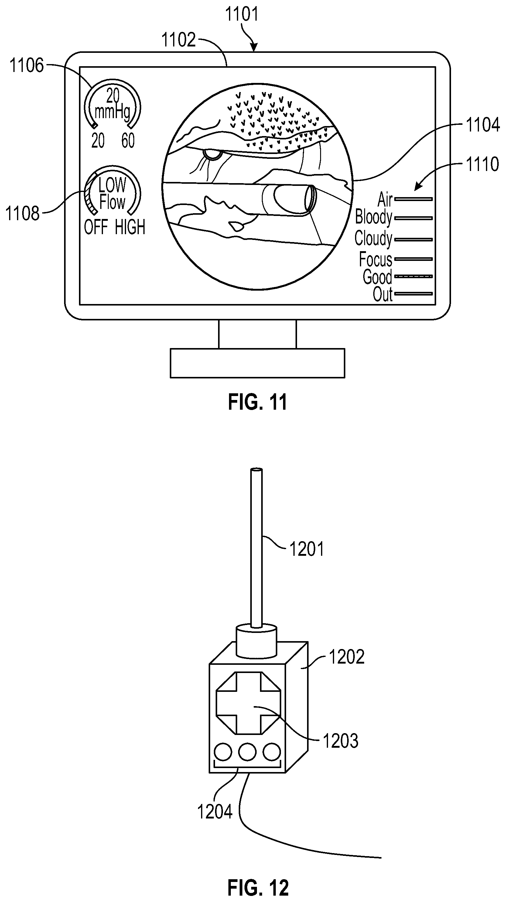 Patent US12096945 Figure 10 – Systems and devices for endoscopic procedure analysis based on state data