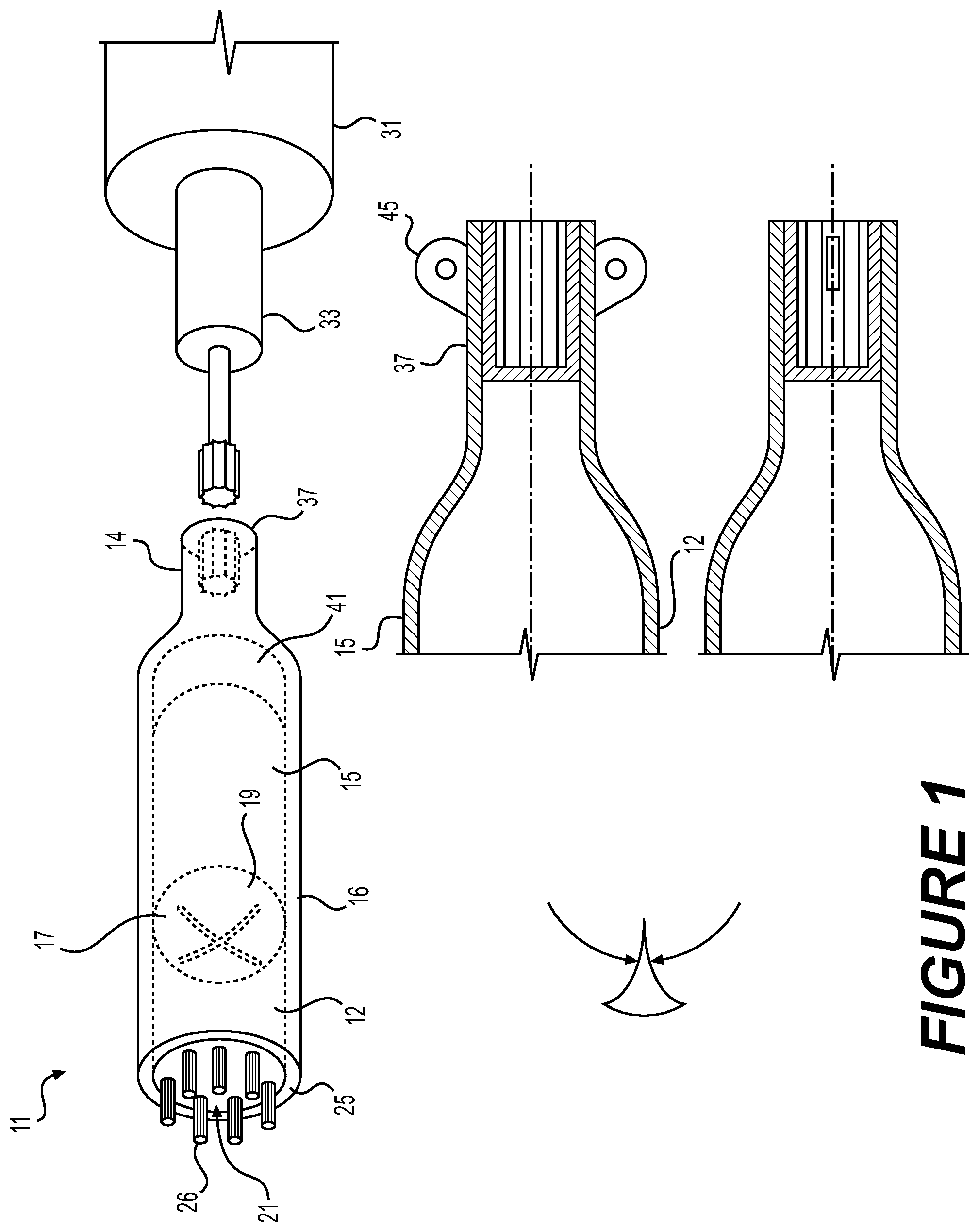 Patent US12096946 Figure 1 – Vertebral disc cutter and method