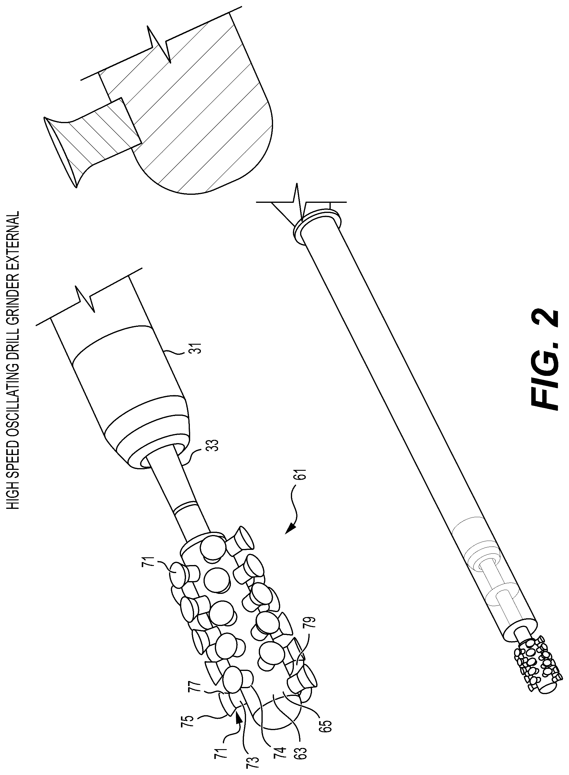Patent US12096946 Figure 2 – Vertebral disc cutter and method
