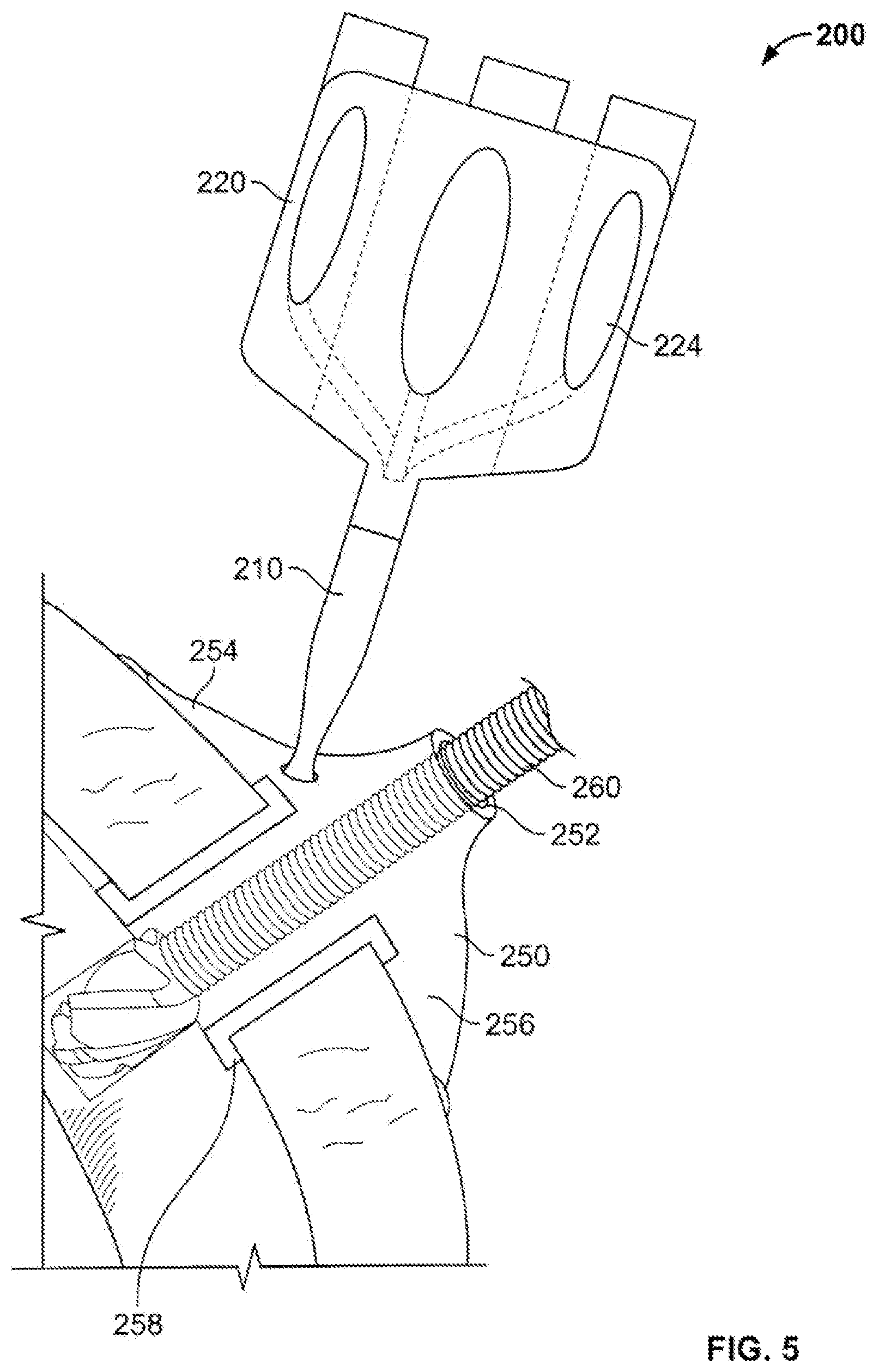Patent US12096947 Figure 5 – Bone marrow harvesting device and storage methods