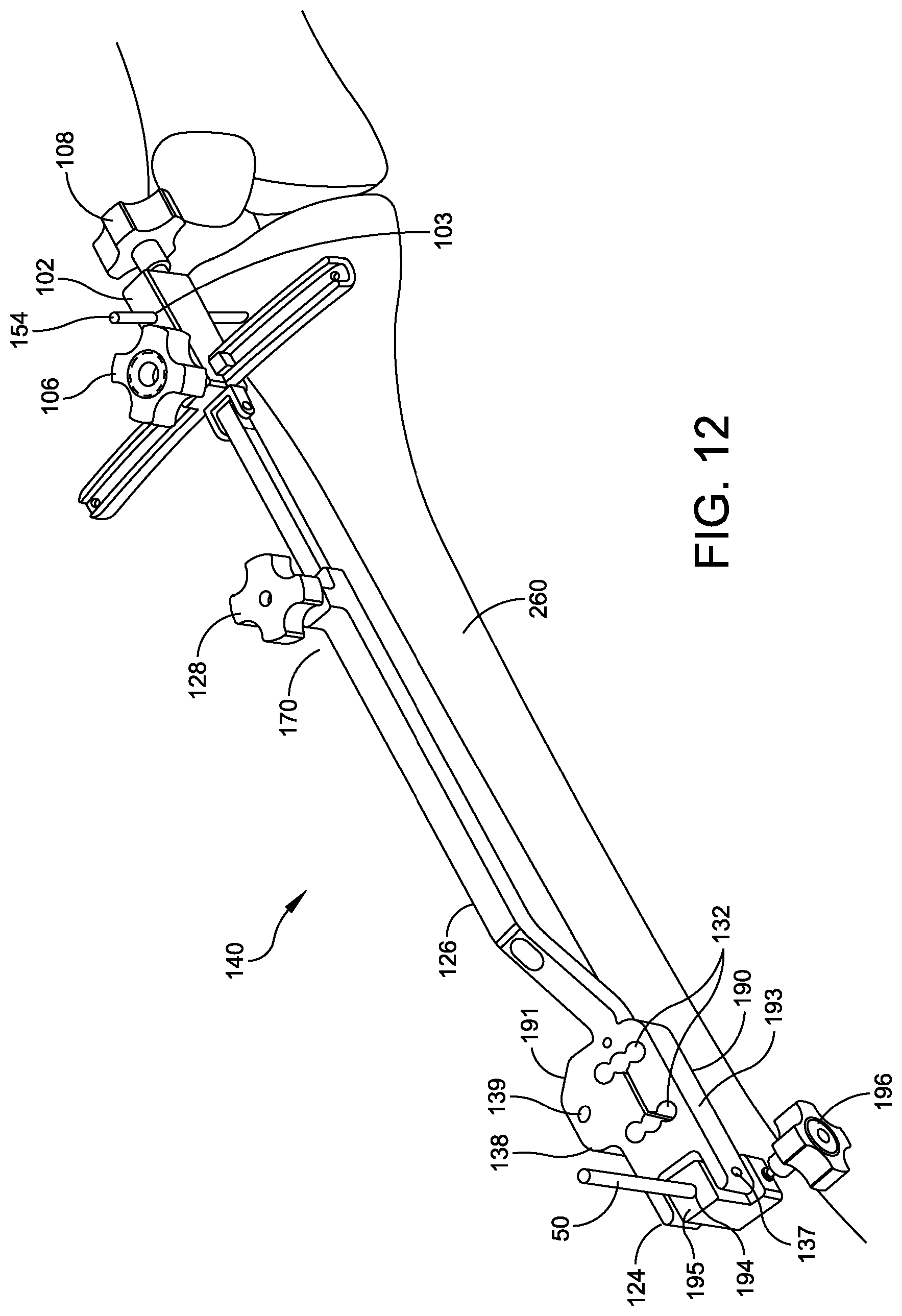 Patent US12096948 Figure 11 – Ankle replacement system and method
