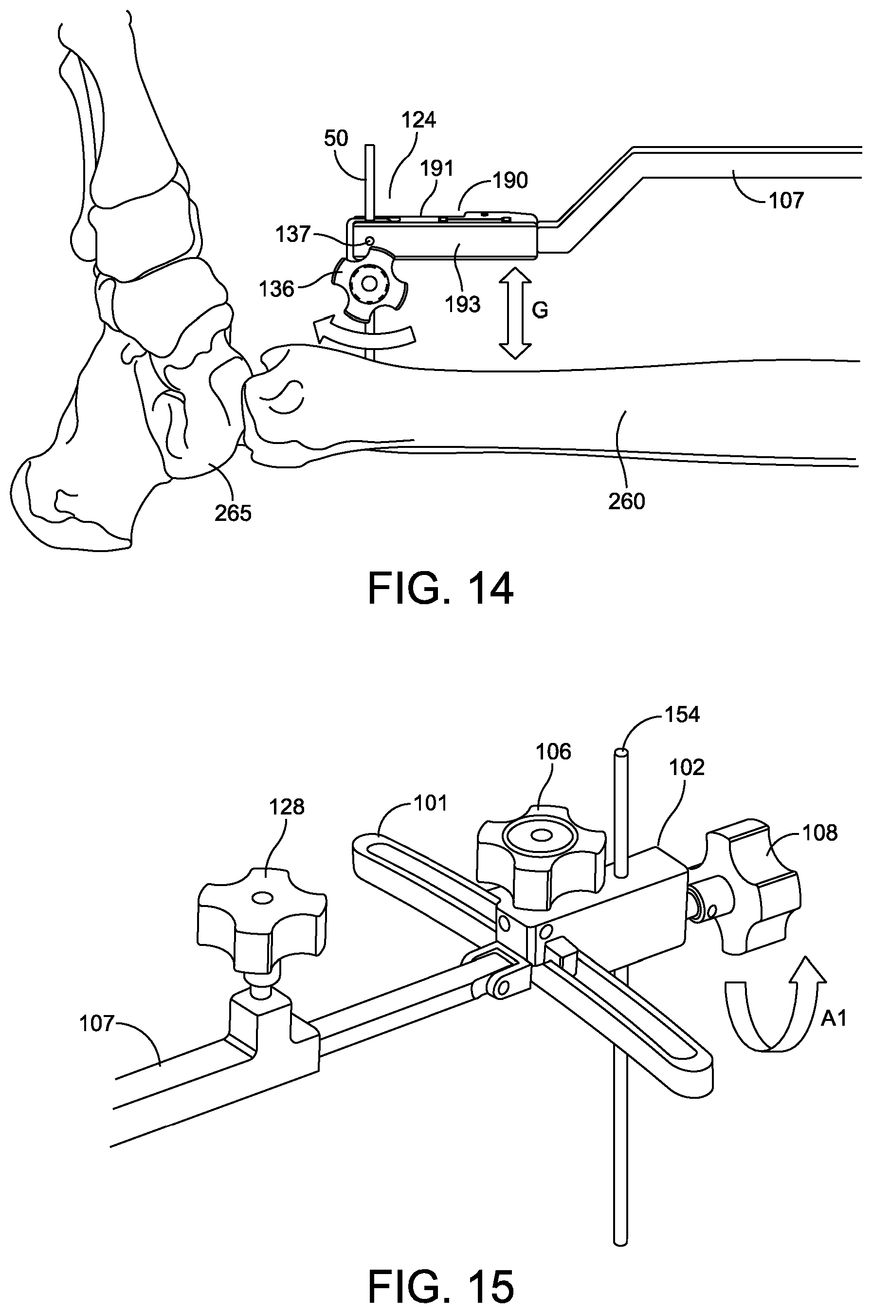 Patent US12096948 Figure 14 – Ankle replacement system and method