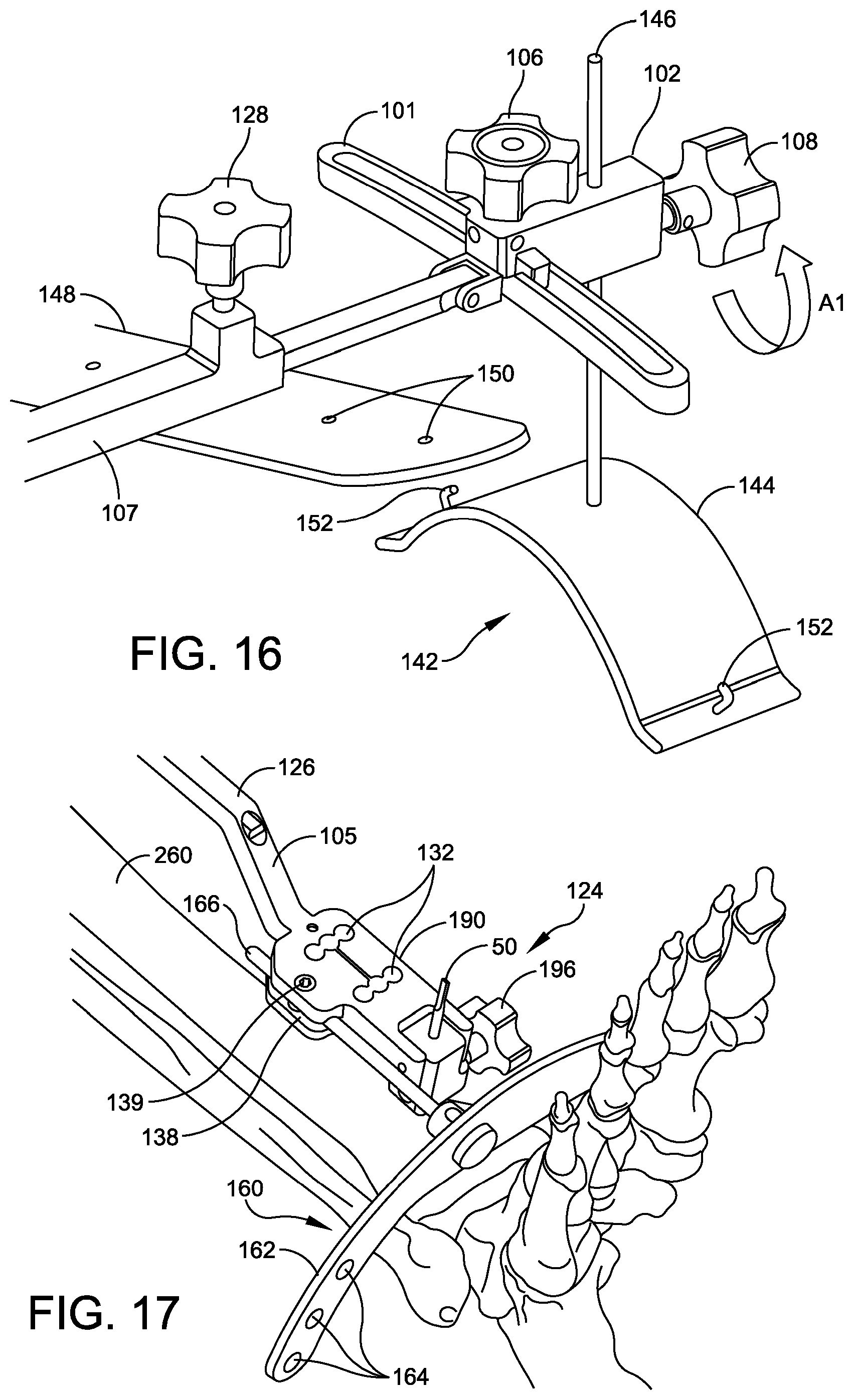 Patent US12096948 Figure 15 – Ankle replacement system and method