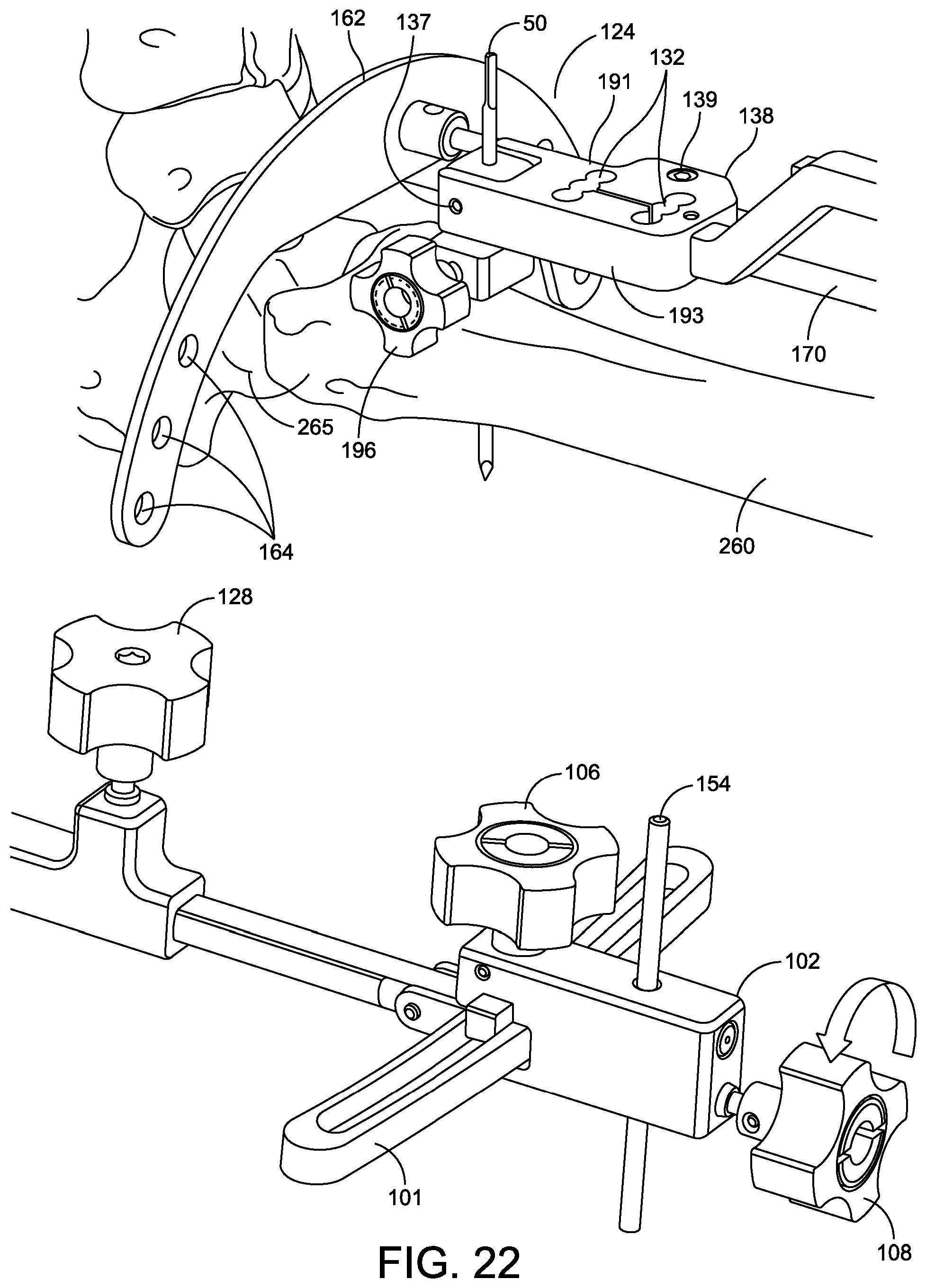 Patent US12096948 Figure 18 – Ankle replacement system and method
