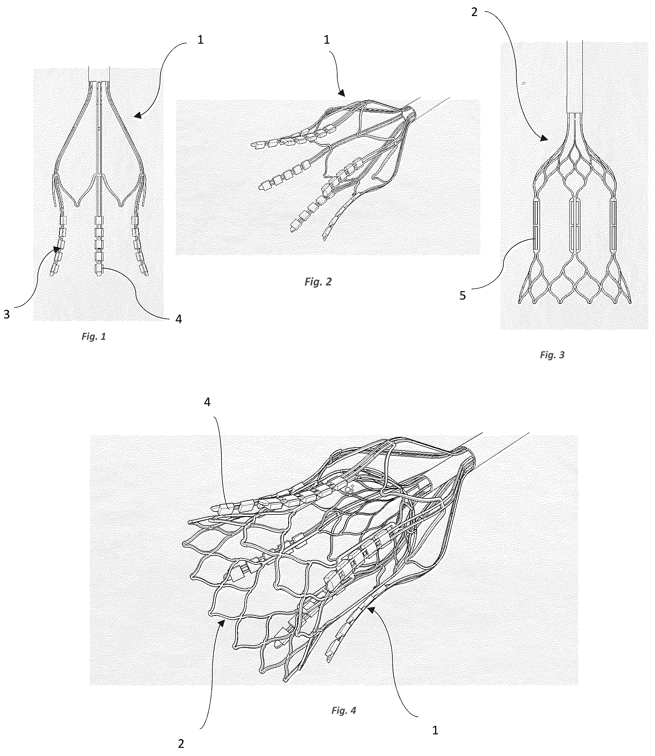 Patent US12096949 — Device for the treatment of tissue calcification — Figure 1