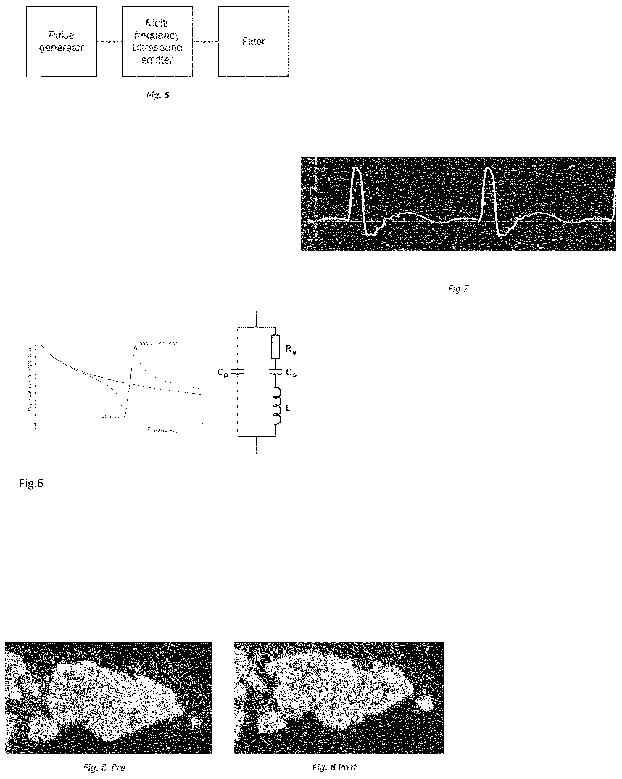 Patent US12096949 Figure 2 – Device for the treatment of tissue calcification