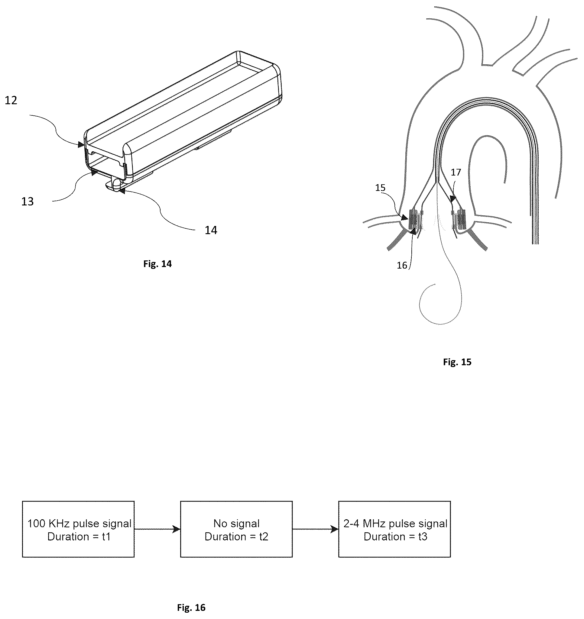 Patent US12096949 Figure 5 – Device for the treatment of tissue calcification