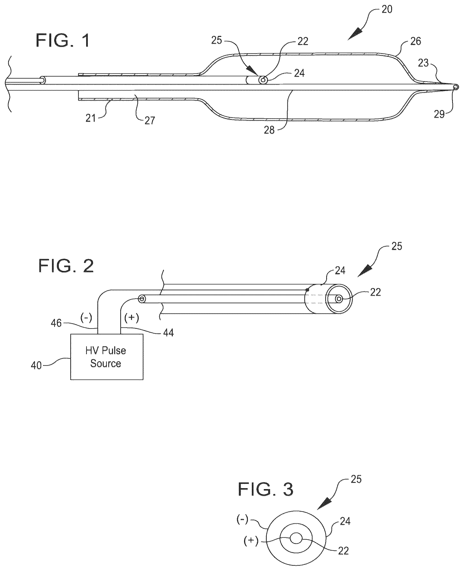 Patent US12096950 Figure 1 – Shockwave catheter system with energy control